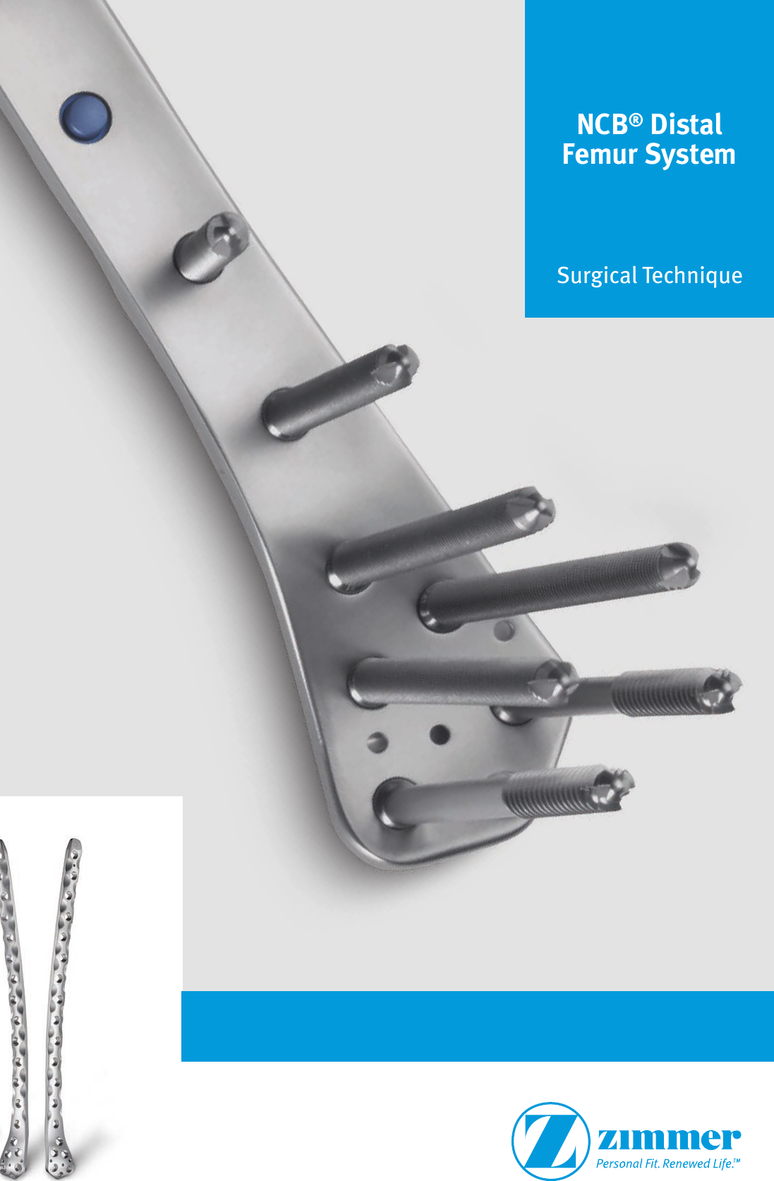 NCB® Distal Femur System Surgical Technique NCB Femoral