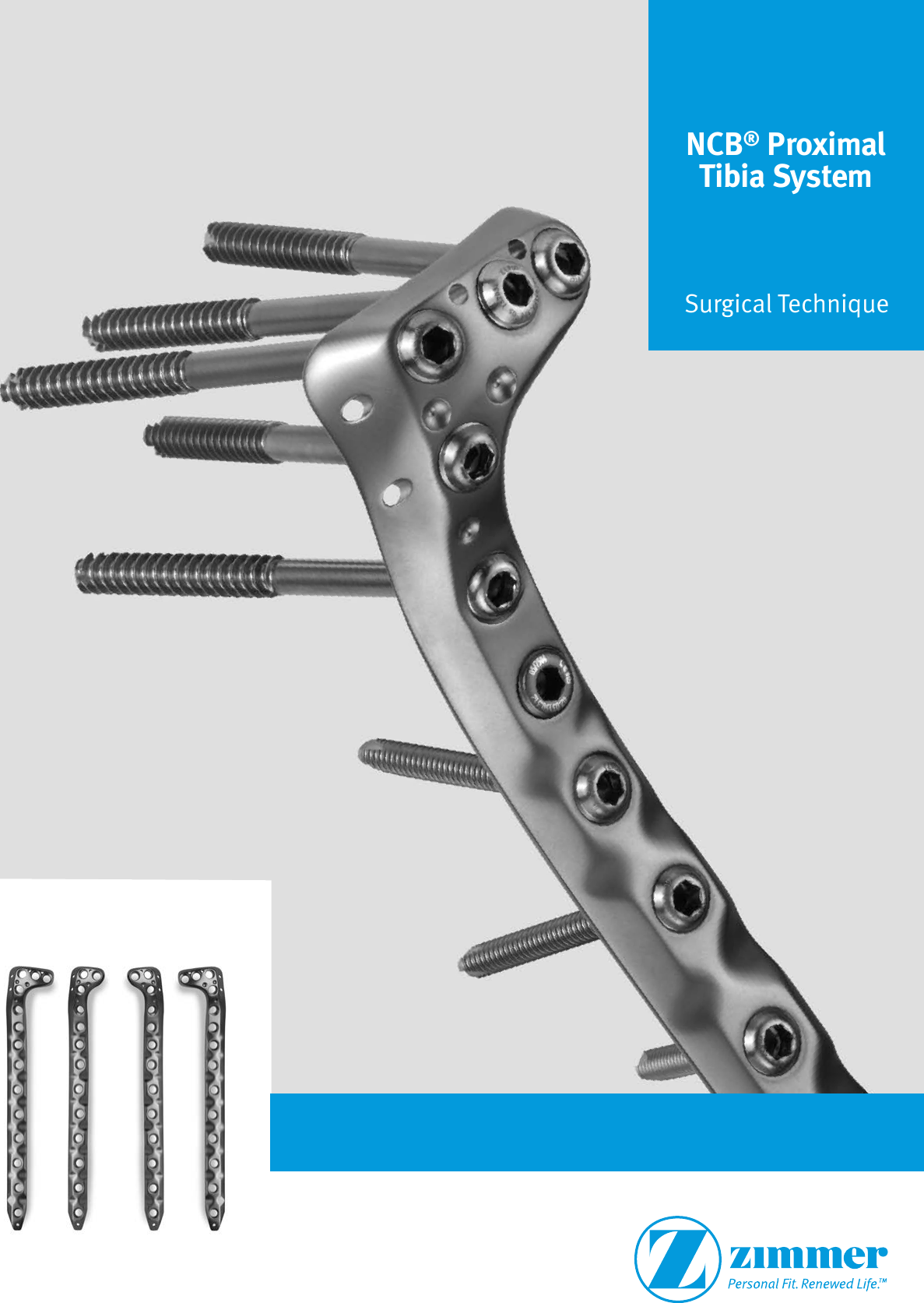 Ncb Proximal Tibia System Surgical Technique Ncb