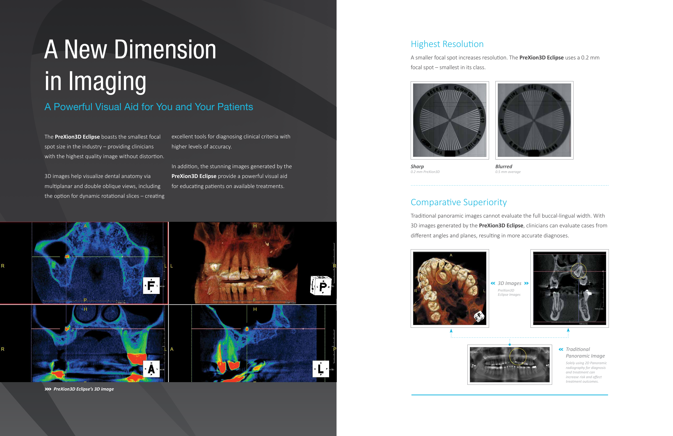 Page 3 of 9 - Pre Xion3D Eclipse Brochure V9