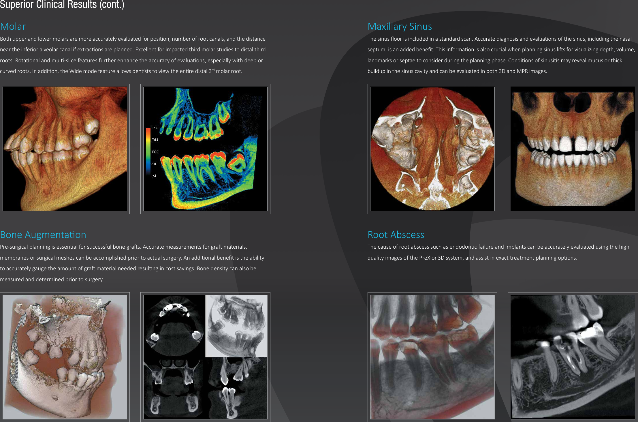 Page 6 of 9 - Pre Xion3D Eclipse Brochure V9