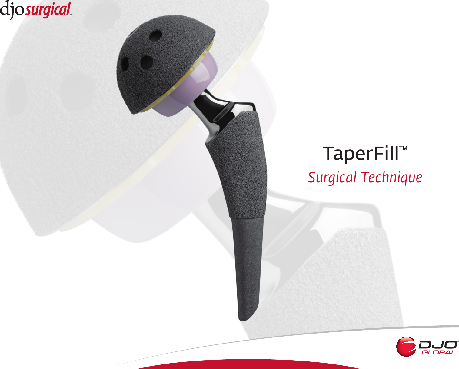 Page 1 of 12 - Taper Fill Surgical Technique Rev C