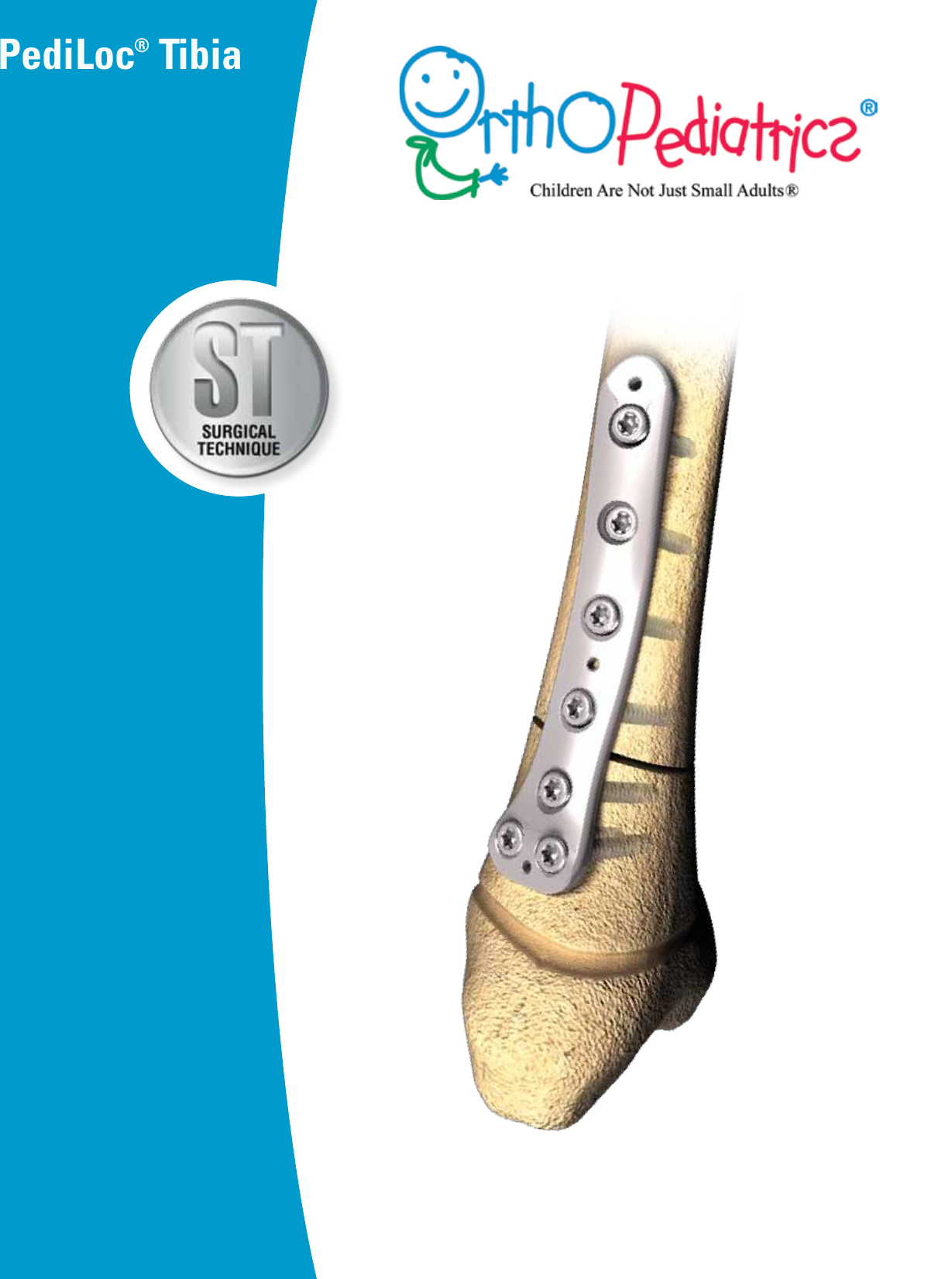 Page 1 of 8 - Tibia Surgical Technique