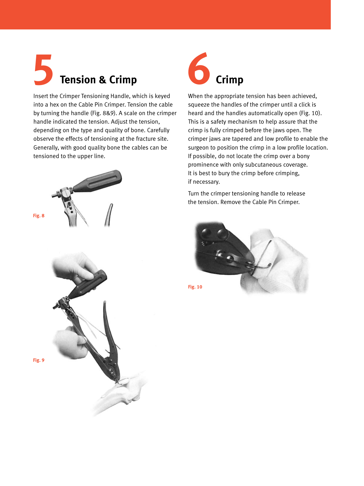 Page 5 of 6 - Zimmer-Cable-Ready-Cable-Pin-System-Abbreviated-Surgical-Technique-Rev2-09-2006