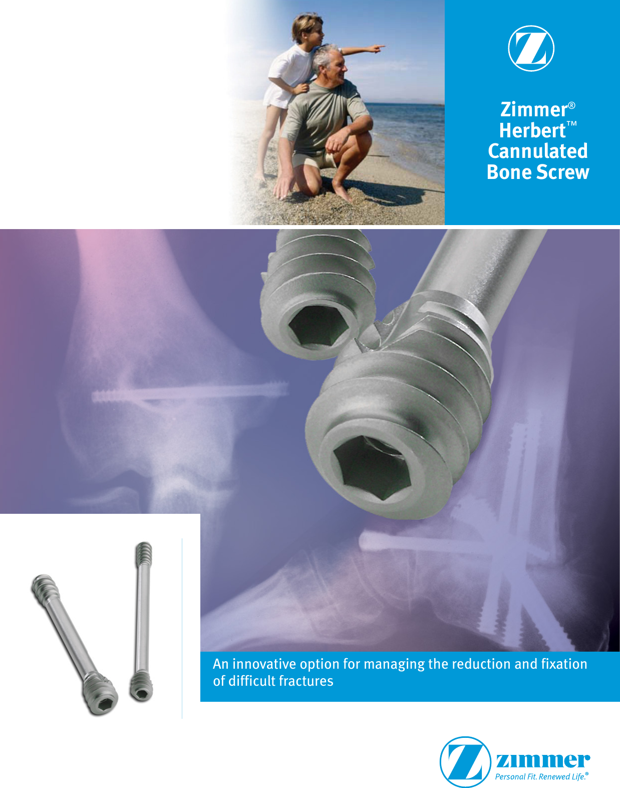 Page 1 of 4 - Zimmer® Herbert™ Cannulated Bone Screw  Zimmer Herbert Surgical Technique