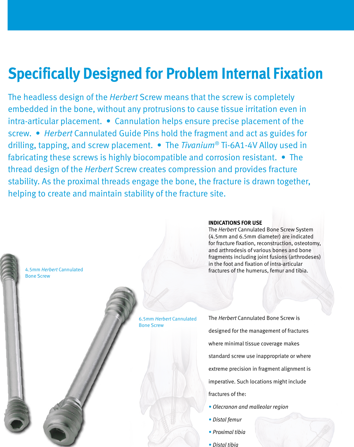 Page 2 of 4 - Zimmer® Herbert™ Cannulated Bone Screw  Zimmer Herbert Surgical Technique