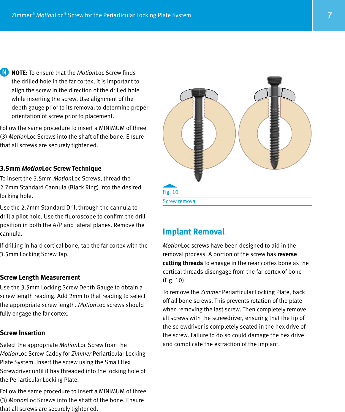 Page 7 of 8 - Zimmer MotionLoc Screw For The Periarticular Locking Plate System Surgical Technique, 97-2347-035-00  Technique