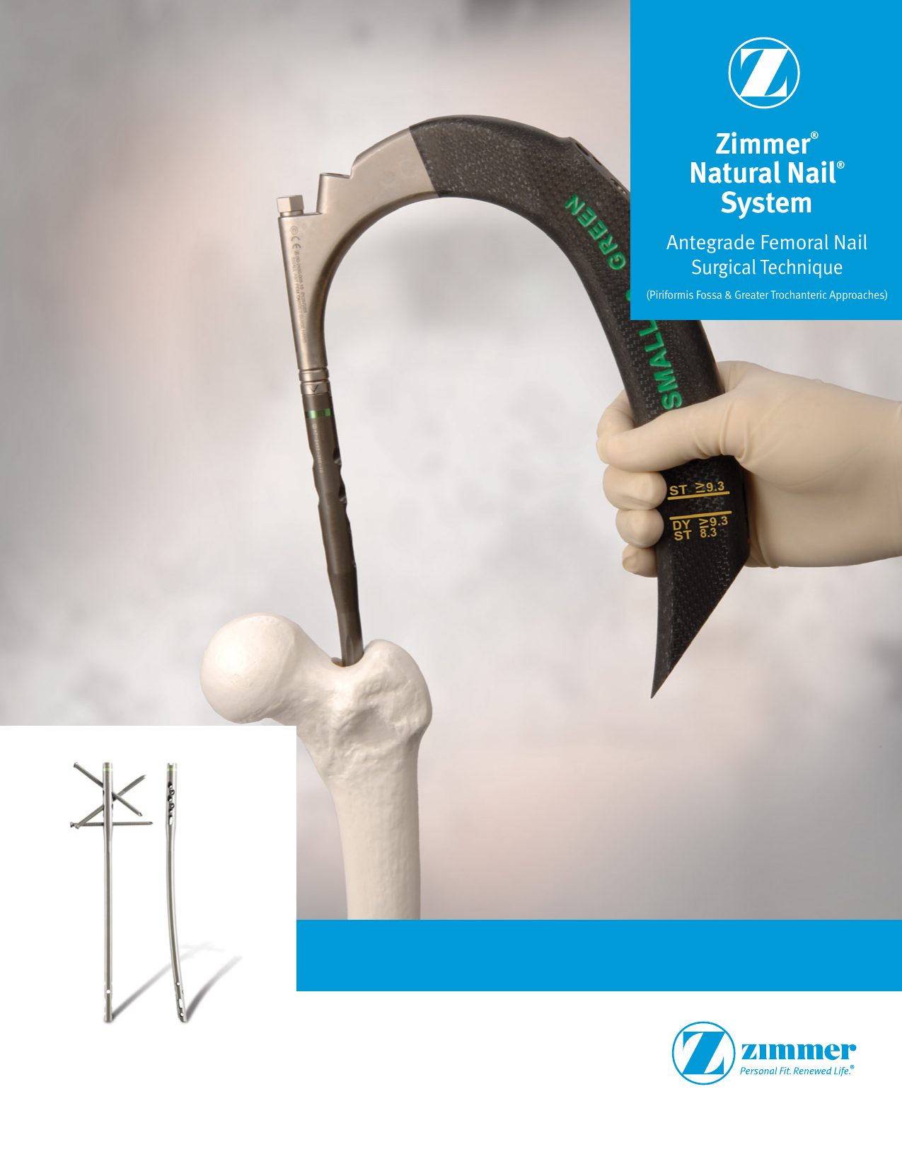 Zimmer® Natural Nail® System Antegrade Femoral Surgical Technique