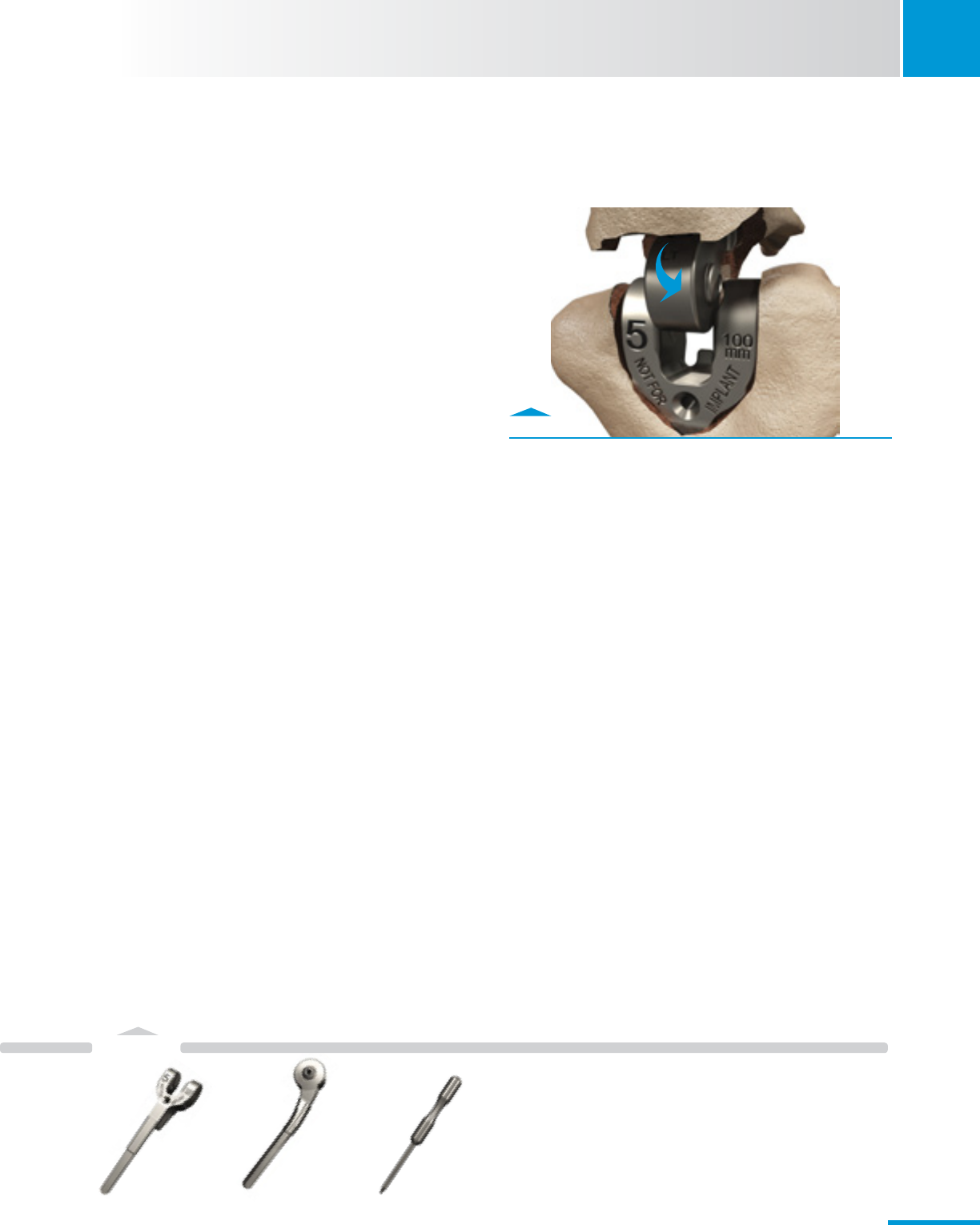 Zimmer Nexel Total Elbow Surgical Technique 97 8401 002 00