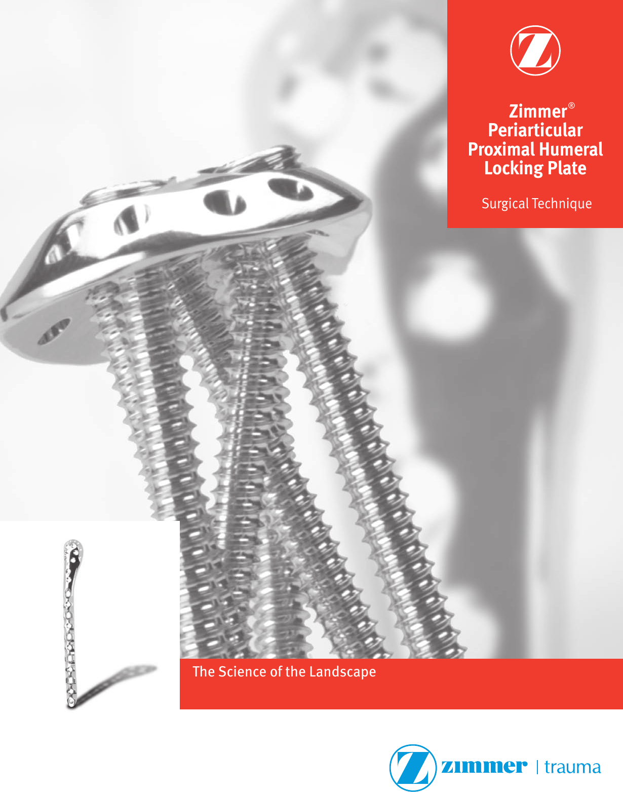 Zimmer Periarticular Proximal Humeral Locking Plate Surgical Technique