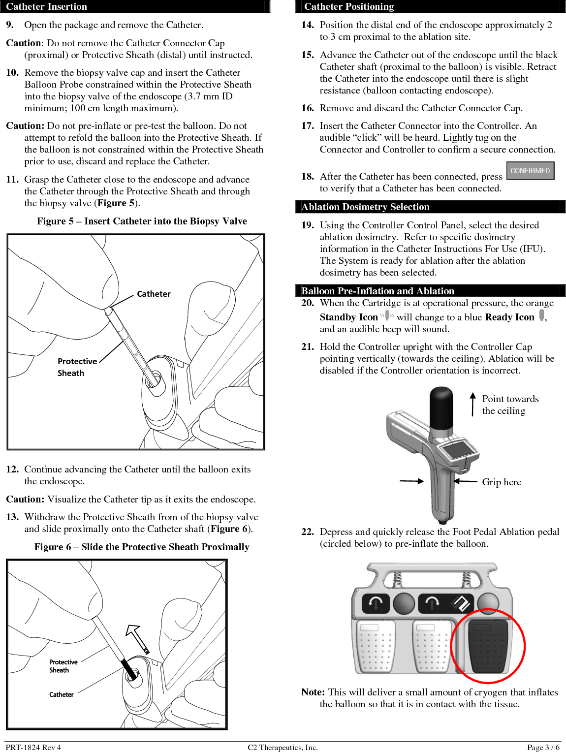PRT-1824 Rev 4  C2 Therapeutics, Inc.  Page 3 / 6 Catheter Insertion 9. Open the package and remove the Catheter. Caution: Do not remove the Catheter Connector Cap (proximal) or Protective Sheath (distal) until instructed. 10. Remove the biopsy valve cap and insert the Catheter Balloon Probe constrained within the Protective Sheath into the biopsy valve of the endoscope (3.7 mm ID minimum; 100 cm length maximum).  Caution: Do not pre-inflate or pre-test the balloon. Do not attempt to refold the balloon into the Protective Sheath. If the balloon is not constrained within the Protective Sheath prior to use, discard and replace the Catheter. 11. Grasp the Catheter close to the endoscope and advance the Catheter through the Protective Sheath and through the biopsy valve (Figure 5). Figure 5 &ndash; Insert Catheter into the Biopsy Valve  12. Continue advancing the Catheter until the balloon exits the endoscope. Caution: Visualize the Catheter tip as it exits the endoscope. 13. Withdraw the Protective Sheath from of the biopsy valve and slide proximally onto the Catheter shaft (Figure 6).   Figure 6 &ndash; Slide the Protective Sheath Proximally   Catheter Positioning  14. Position the distal end of the endoscope approximately 2 to 3 cm proximal to the ablation site. 15. Advance the Catheter out of the endoscope until the black Catheter shaft (proximal to the balloon) is visible. Retract the Catheter into the endoscope until there is slight resistance (balloon contacting endoscope).  16. Remove and discard the Catheter Connector Cap. 17. Insert the Catheter Connector into the Controller. An audible &ldquo;click&rdquo; will be heard. Lightly tug on the Connector and Controller to confirm a secure connection. 18. After the Catheter has been connected, press   to verify that a Catheter has been connected. Ablation Dosimetry Selection 19. Using the Controller Control Panel, select the desired ablation dosimetry.  Refer to specific dosimetry information in the Catheter Instructions For Use (IFU). The System is ready for ablation after the ablation dosimetry has been selected. Balloon Pre-Inflation and Ablation 20. When the Cartridge is at operational pressure, the orange Standby Icon  will change to a blue Ready Icon  , and an audible beep will sound. 21. Hold the Controller upright with the Controller Cap pointing vertically (towards the ceiling). Ablation will be disabled if the Controller orientation is incorrect.      22. Depress and quickly release the Foot Pedal Ablation pedal  (circled below) to pre-inflate the balloon.  Note: This will deliver a small amount of cryogen that inflates the balloon so that it is in contact with the tissue.  Protective Sheath Catheter Point towards the ceiling      Grip here 