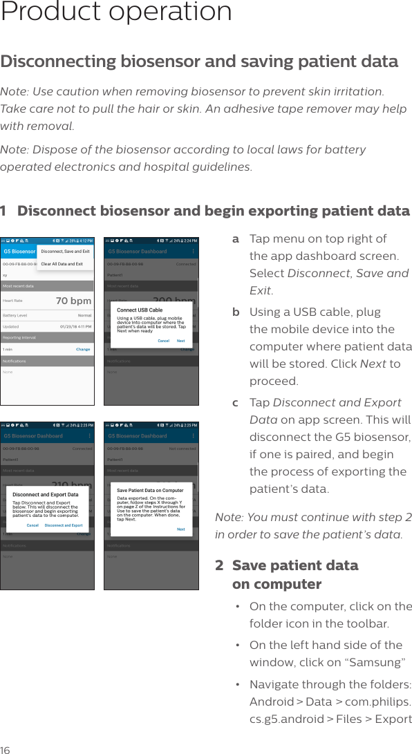 16Product operationDisconnecting biosensor and saving patient dataNote: Use caution when removing biosensor to prevent skin irritation.  Take care not to pull the hair or skin. An adhesive tape remover may help with removal.Note: Dispose of the biosensor according to local laws for battery operated electronics and hospital guidelines.1  Disconnect biosensor and begin exporting patient dataa  Tap menu on top right of the app dashboard screen. Select Disconnect, Save and Exit. b  Using a USB cable, plug the mobile device into the computer where patient data will be stored. Click Next to proceed.c  Tap Disconnect and Export Data on app screen. This will disconnect the G5 biosensor, if one is paired, and begin the process of exporting the patient&rsquo;s data. Note: You must continue with step 2  in order to save the patient&rsquo;s data.2  Save patient data    on computer&bull;  On the computer, click on the folder icon in the toolbar.&bull;  On the left hand side of the window, click on &ldquo;Samsung&rdquo;&bull;  Navigate through the folders: Android > Data > com.philips.cs.g5.android > Files > Export