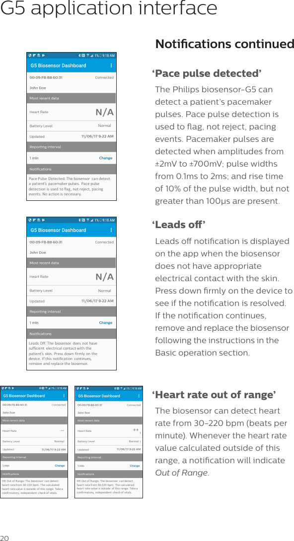 20Notications continued &lsquo;Pace pulse detected&rsquo;The Philips biosensor-G5 can detect a patient&rsquo;s pacemaker pulses. Pace pulse detection is used to ag, not reject, pacing events. Pacemaker pulses are detected when amplitudes from &plusmn;2mV to &plusmn;700mV; pulse widths from 0.1ms to 2ms; and rise time of 10% of the pulse width, but not greater than 100&mu;s are present. &lsquo;Leads  o&rsquo;Leads o notication is displayed on the app when the biosensor does not have appropriate electrical contact with the skin. Press down rmly on the device to see if the notication is resolved.  If the notication continues, remove and replace the biosensor following the instructions in the Basic operation section. &lsquo;Heart rate out of range&rsquo;The biosensor can detect heart rate from 30-220 bpm (beats per minute). Whenever the heart rate value calculated outside of this range, a notication will indicate Out of Range.G5 application interfaceNorma lHROut-of-Range++HROutofRange:Thebiosensor candetectheartratefrom30-220bpm.  Thecalcula tedhear tra tevalue isoutside of this rang e.Takeaconfir matory, independe nt check ofvita ls.Norma lHROutofRange:Thebiosensor candetectheartratefrom30-220bpm.  Thecalcula tedhear tra tevalue isoutside of this rang e.Takeaconfir matory, independe nt check ofvita ls.--NormalPacePulseDetected:Thebiosensor candetectapa tient&rsquo;s pacemakerpulses. Pacepulsedetection isused toflag,notreject, pacingevents.Noact ionis necessary.NormalLeads Off:The biosensor does nothavesufficient electricalcontactwith thepatient&rsquo;s skin.Pressdown firmly ont hedevice.Ifthis notifica tion continues,remove andreplace the biosensor.