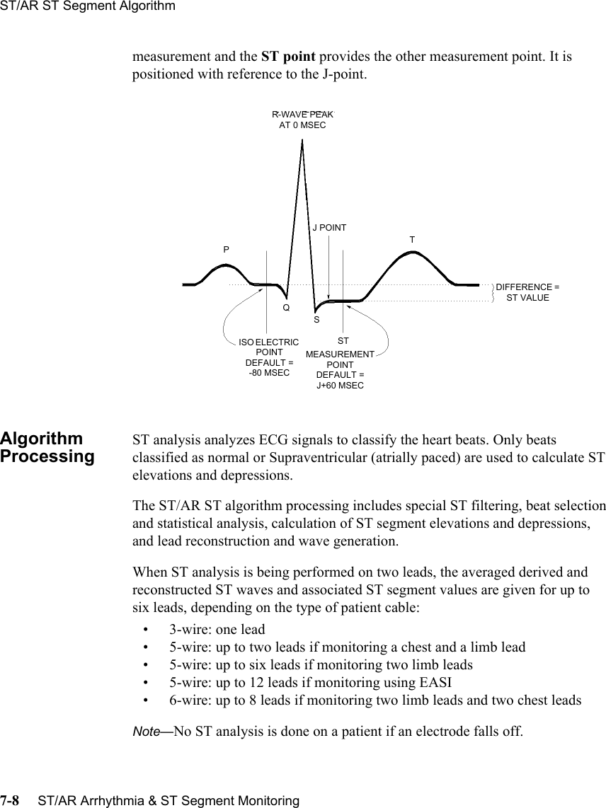 ST/AR ST Segment Algorithm7-8     ST/AR Arrhythmia &amp; ST Segment Monitoringmeasurement and the ST point provides the other measurement point. It is positioned with reference to the J-point.Algorithm ProcessingST analysis analyzes ECG signals to classify the heart beats. Only beats classified as normal or Supraventricular (atrially paced) are used to calculate ST elevations and depressions.The ST/AR ST algorithm processing includes special ST filtering, beat selection and statistical analysis, calculation of ST segment elevations and depressions, and lead reconstruction and wave generation. When ST analysis is being performed on two leads, the averaged derived and reconstructed ST waves and associated ST segment values are given for up to six leads, depending on the type of patient cable:• 3-wire: one lead• 5-wire: up to two leads if monitoring a chest and a limb lead• 5-wire: up to six leads if monitoring two limb leads• 5-wire: up to 12 leads if monitoring using EASI• 6-wire: up to 8 leads if monitoring two limb leads and two chest leadsNote—No ST analysis is done on a patient if an electrode falls off.R-WAVE PEAK AT 0 MSECJ POINTISO ELECTRIC POINT DEFAULT = -80 MSECMEASUREMENT POINT DEFAULT = J+60 MSECDIFFERENCE = ST VALUEPQSSTT
