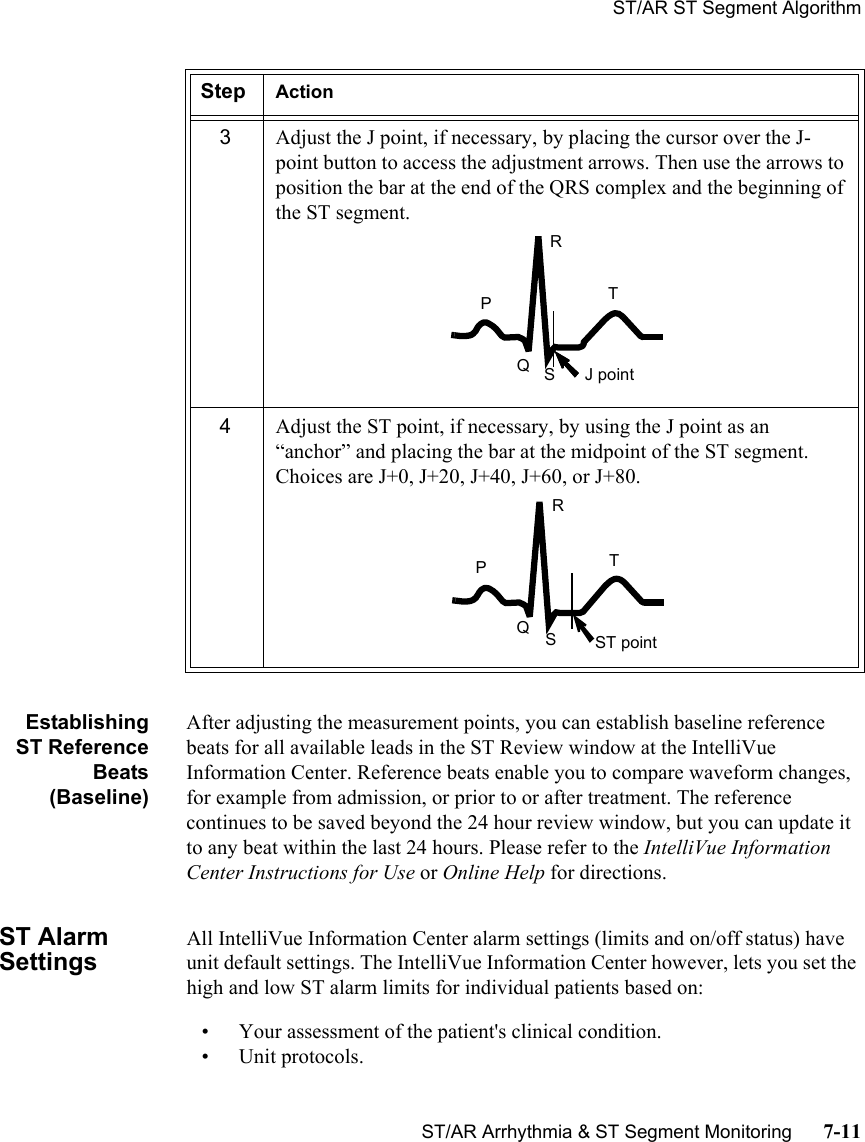 ST/AR ST Segment AlgorithmST/AR Arrhythmia &amp; ST Segment Monitoring      7-11EstablishingST ReferenceBeats(Baseline)After adjusting the measurement points, you can establish baseline reference beats for all available leads in the ST Review window at the IntelliVue  Information Center. Reference beats enable you to compare waveform changes, for example from admission, or prior to or after treatment. The reference continues to be saved beyond the 24 hour review window, but you can update it to any beat within the last 24 hours. Please refer to the IntelliVue Information Center Instructions for Use or Online Help for directions.ST Alarm SettingsAll IntelliVue Information Center alarm settings (limits and on/off status) have unit default settings. The IntelliVue Information Center however, lets you set the high and low ST alarm limits for individual patients based on:• Your assessment of the patient&apos;s clinical condition.• Unit protocols.3Adjust the J point, if necessary, by placing the cursor over the J-point button to access the adjustment arrows. Then use the arrows to position the bar at the end of the QRS complex and the beginning of the ST segment.4Adjust the ST point, if necessary, by using the J point as an “anchor” and placing the bar at the midpoint of the ST segment. Choices are J+0, J+20, J+40, J+60, or J+80.Step ActionTRPSQJ pointTRPSQST point