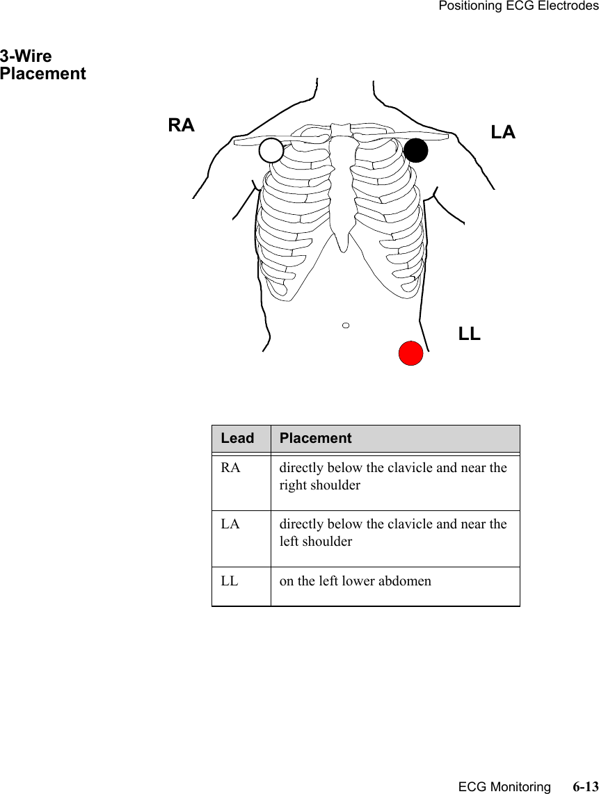 Positioning ECG Electrodes   ECG Monitoring      6-133-Wire PlacementLead PlacementRA directly below the clavicle and near the right shoulderLA directly below the clavicle and near the left shoulderLL on the left lower abdomenRA LALL