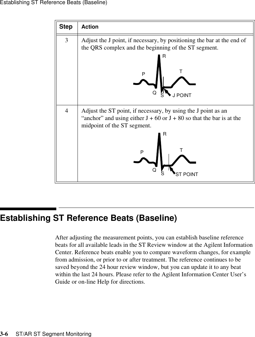 Establishing ST Reference Beats (Baseline)3-6     ST/AR ST Segment MonitoringEstablishing ST Reference Beats (Baseline)After adjusting the measurement points, you can establish baseline reference beats for all available leads in the ST Review window at the Agilent Information Center. Reference beats enable you to compare waveform changes, for example from admission, or prior to or after treatment. The reference continues to be saved beyond the 24 hour review window, but you can update it to any beat within the last 24 hours. Please refer to the Agilent Information Center User’s Guide or on-line Help for directions.3 Adjust the J point, if necessary, by positioning the bar at the end of the QRS complex and the beginning of the ST segment.4 Adjust the ST point, if necessary, by using the J point as an “anchor” and using either J + 60 or J + 80 so that the bar is at the midpoint of the ST segment.Step ActionTRPSQJ POINTTRPSQST POINT