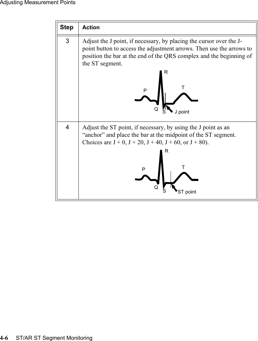 Adjusting Measurement Points4-6     ST/AR ST Segment Monitoring3Adjust the J point, if necessary, by placing the cursor over the J-point button to access the adjustment arrows. Then use the arrows to position the bar at the end of the QRS complex and the beginning of the ST segment.4Adjust the ST point, if necessary, by using the J point as an “anchor” and place the bar at the midpoint of the ST segment. Choices are J + 0, J + 20, J + 40, J + 60, or J + 80).Step ActionTRPSQJ pointTRPSQST point