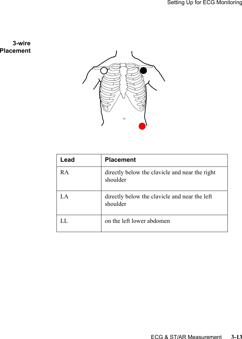 Setting Up for ECG MonitoringECG &amp; ST/AR Measurement      3-133-wirePlacementLead PlacementRA directly below the clavicle and near the right shoulderLA directly below the clavicle and near the left shoulderLL on the left lower abdomen