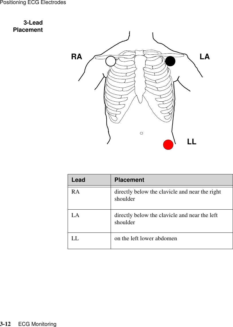 Positioning ECG Electrodes3-12     ECG Monitoring   3-LeadPlacementLead PlacementRA directly below the clavicle and near the right shoulderLA directly below the clavicle and near the left shoulderLL on the left lower abdomenRA LALL