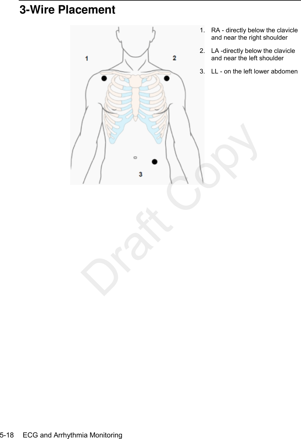    5-18    ECG and Arrhythmia Monitoring  3-Wire Placement  1.  RA - directly below the clavicle and near the right shoulder 2.  LA -directly below the clavicle and near the left shoulder 3. LL - on the left lower abdomen   Draft Copy