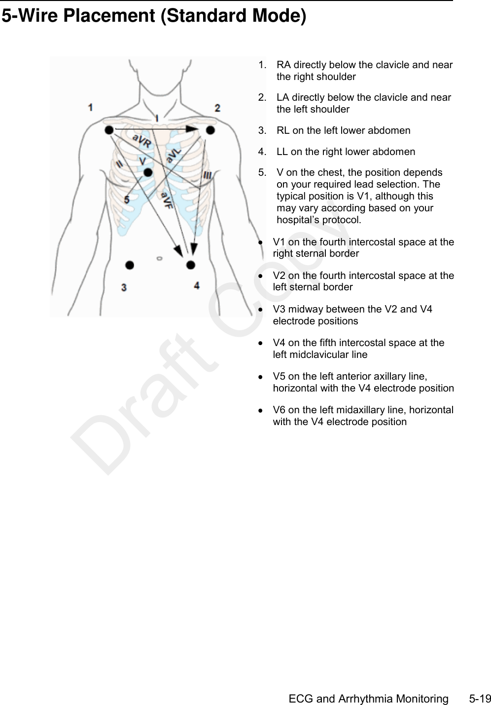      ECG and Arrhythmia Monitoring        5-19 5-Wire Placement (Standard Mode)   1.  RA directly below the clavicle and near the right shoulder 2.  LA directly below the clavicle and near the left shoulder 3.  RL on the left lower abdomen 4.  LL on the right lower abdomen 5.  V on the chest, the position depends on your required lead selection. The typical position is V1, although this may vary according based on your hospital’s protocol.   V1 on the fourth intercostal space at the right sternal border   V2 on the fourth intercostal space at the left sternal border   V3 midway between the V2 and V4 electrode positions   V4 on the fifth intercostal space at the left midclavicular line   V5 on the left anterior axillary line, horizontal with the V4 electrode position   V6 on the left midaxillary line, horizontal with the V4 electrode position   Draft Copy
