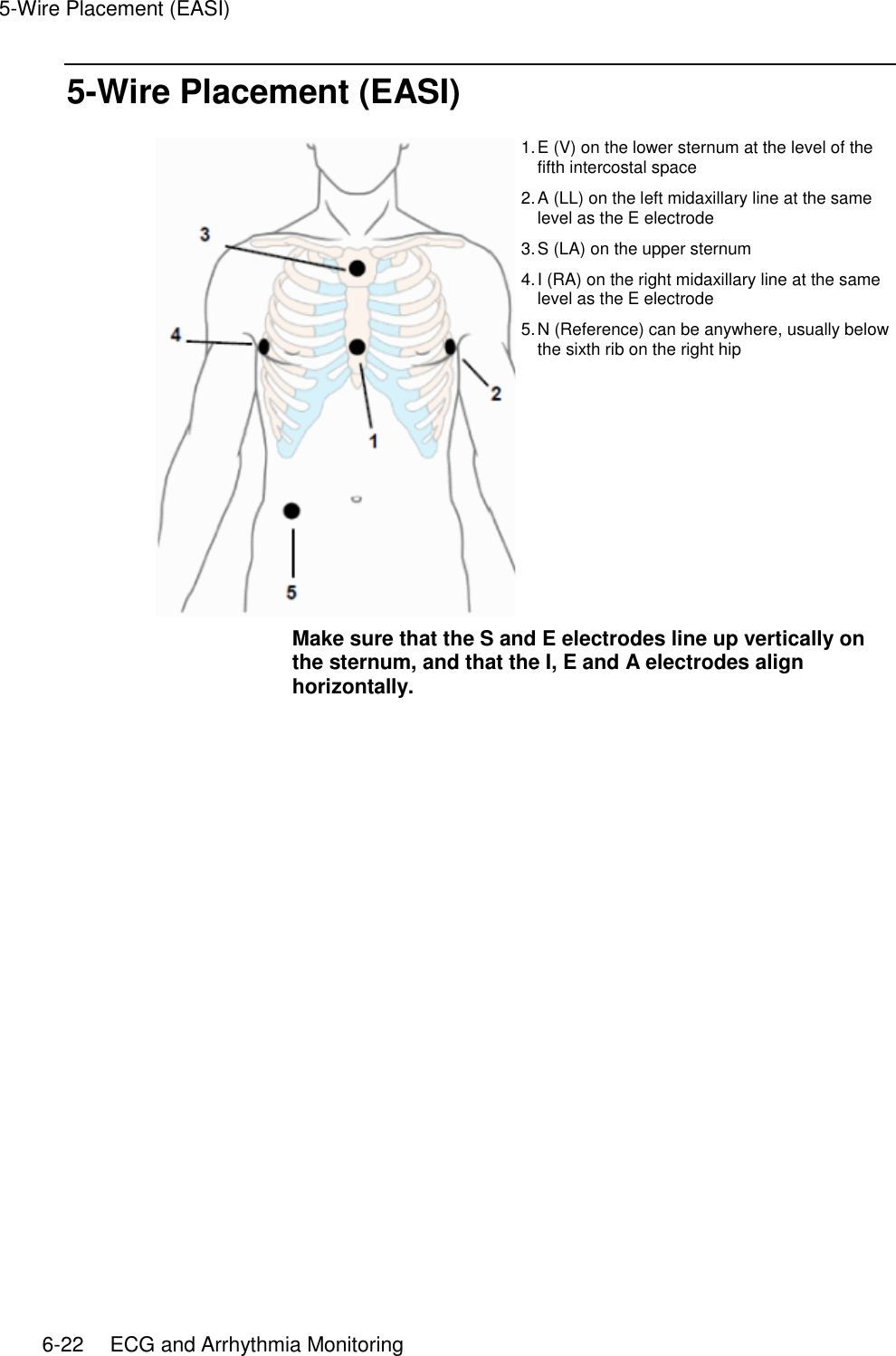 5-Wire Placement (EASI)   6-22    ECG and Arrhythmia Monitoring 5-Wire Placement (EASI)  1. E (V) on the lower sternum at the level of the fifth intercostal space 2. A (LL) on the left midaxillary line at the same level as the E electrode 3. S (LA) on the upper sternum 4. I (RA) on the right midaxillary line at the same level as the E electrode 5. N (Reference) can be anywhere, usually below the sixth rib on the right hip Make sure that the S and E electrodes line up vertically on the sternum, and that the I, E and A electrodes align horizontally.   