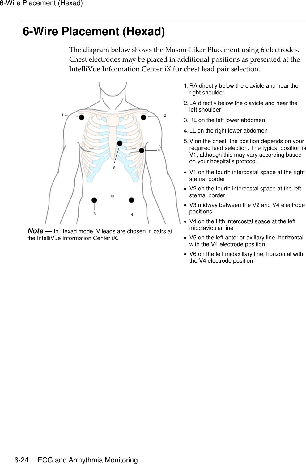 6-Wire Placement (Hexad)   6-24    ECG and Arrhythmia Monitoring 6-Wire Placement (Hexad) The diagram below shows the Mason-Likar Placement using 6 electrodes. Chest electrodes may be placed in additional positions as presented at the IntelliVue Information Center iX for chest lead pair selection.  Note — In Hexad mode, V leads are chosen in pairs at the IntelliVue Information Center iX. 1. RA directly below the clavicle and near the right shoulder 2. LA directly below the clavicle and near the left shoulder 3. RL on the left lower abdomen 4. LL on the right lower abdomen 5. V on the chest, the position depends on your required lead selection. The typical position is V1, although this may vary according based on your hospital’s protocol.   V1 on the fourth intercostal space at the right sternal border   V2 on the fourth intercostal space at the left sternal border   V3 midway between the V2 and V4 electrode positions   V4 on the fifth intercostal space at the left midclavicular line   V5 on the left anterior axillary line, horizontal with the V4 electrode position   V6 on the left midaxillary line, horizontal with the V4 electrode position   