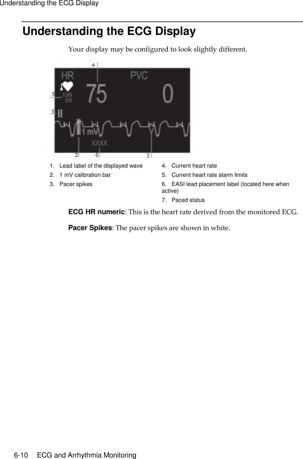 Understanding the ECG Display   6-10    ECG and Arrhythmia Monitoring Understanding the ECG Display Your display may be configured to look slightly different.  1.    Lead label of the displayed wave 2.    1 mV calibration bar 3.    Pacer spikes 4.    Current heart rate 5.    Current heart rate alarm limits 6.    EASI lead placement label (located here when active) 7.    Paced status ECG HR numeric: This is the heart rate derived from the monitored ECG. Pacer Spikes: The pacer spikes are shown in white.  