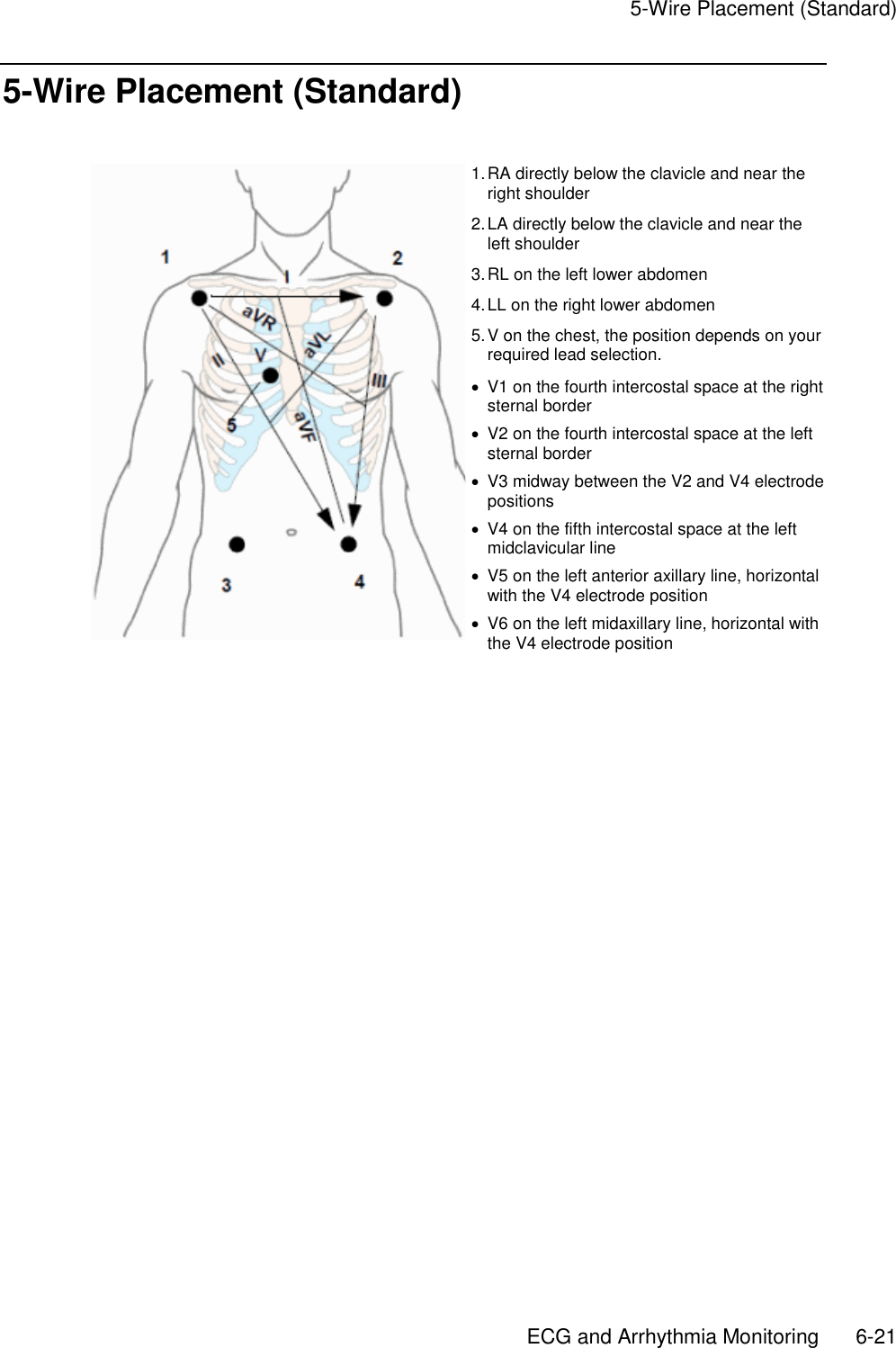     5-Wire Placement (Standard)       ECG and Arrhythmia Monitoring        6-21 5-Wire Placement (Standard)   1. RA directly below the clavicle and near the right shoulder 2. LA directly below the clavicle and near the left shoulder 3. RL on the left lower abdomen 4. LL on the right lower abdomen 5. V on the chest, the position depends on your required lead selection.   V1 on the fourth intercostal space at the right sternal border   V2 on the fourth intercostal space at the left sternal border   V3 midway between the V2 and V4 electrode positions   V4 on the fifth intercostal space at the left midclavicular line   V5 on the left anterior axillary line, horizontal with the V4 electrode position   V6 on the left midaxillary line, horizontal with the V4 electrode position   