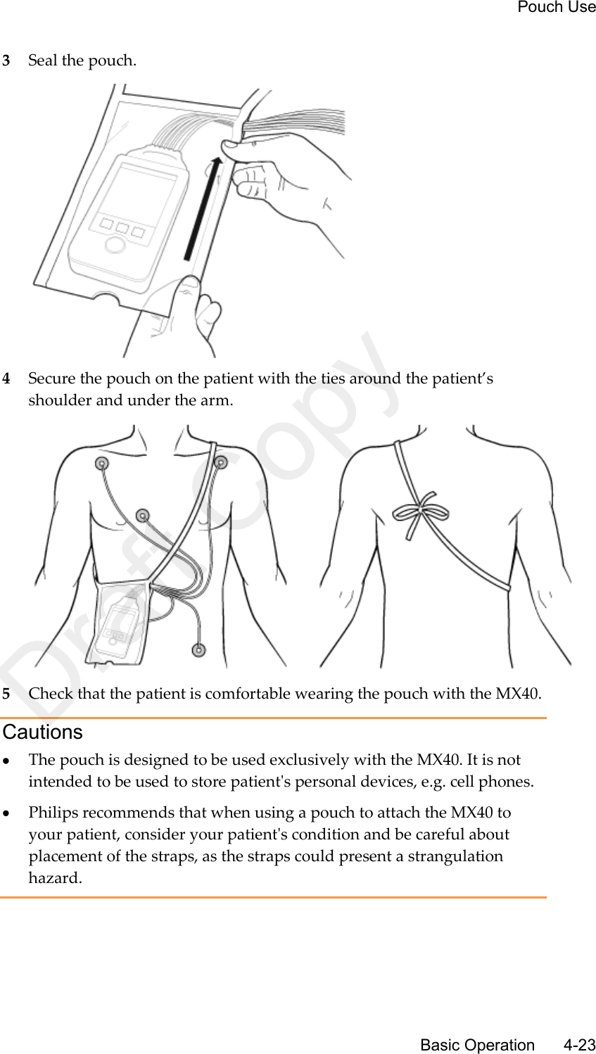     Pouch Use       Basic Operation      4-23 3 Seal the pouch.  4 Secure the pouch on the patient with the ties around the patient’s shoulder and under the arm.  5 Check that the patient is comfortable wearing the pouch with the MX40.   Cautions  The pouch is designed to be used exclusively with the MX40. It is not intended to be used to store patient&apos;s personal devices, e.g. cell phones.  Philips recommends that when using a pouch to attach the MX40 to your patient, consider your patient&apos;s condition and be careful about placement of the straps, as the straps could present a strangulation hazard.   Draft Copy