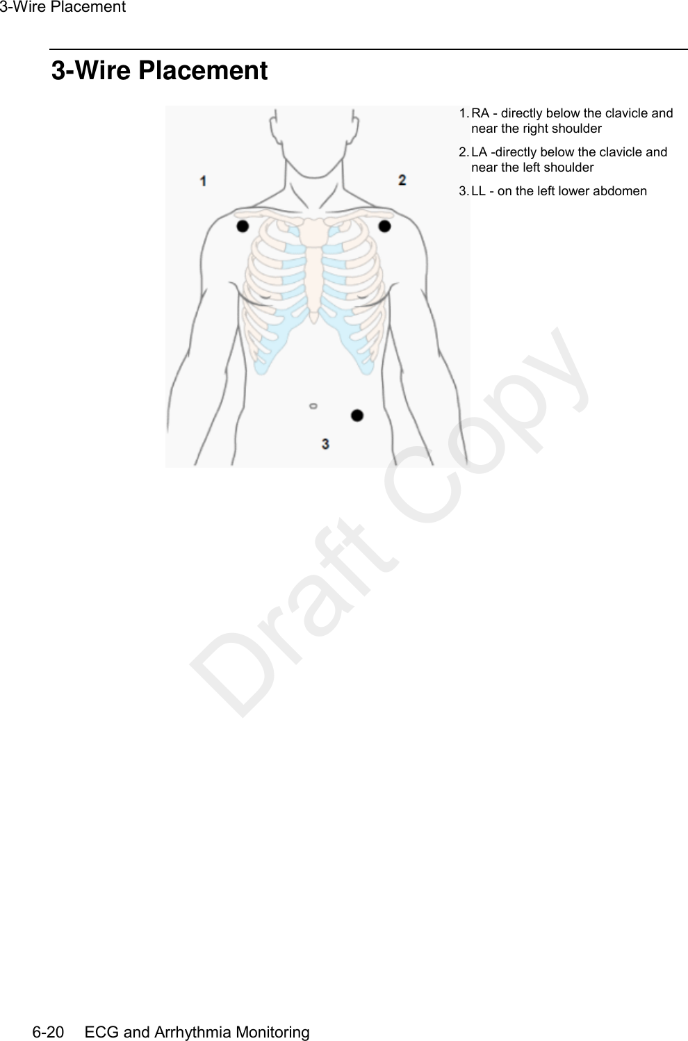 3-Wire Placement   6-20    ECG and Arrhythmia Monitoring 3-Wire Placement  1. RA - directly below the clavicle and near the right shoulder 2. LA -directly below the clavicle and near the left shoulder 3. LL - on the left lower abdomen   Draft Copy