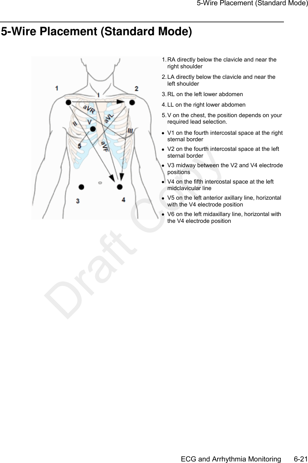     5-Wire Placement (Standard Mode)       ECG and Arrhythmia Monitoring      6-21 5-Wire Placement (Standard Mode)   1. RA directly below the clavicle and near the right shoulder 2. LA directly below the clavicle and near the left shoulder 3. RL on the left lower abdomen 4. LL on the right lower abdomen 5. V on the chest, the position depends on your required lead selection.   V1 on the fourth intercostal space at the right sternal border   V2 on the fourth intercostal space at the left sternal border   V3 midway between the V2 and V4 electrode positions   V4 on the fifth intercostal space at the left midclavicular line   V5 on the left anterior axillary line, horizontal with the V4 electrode position   V6 on the left midaxillary line, horizontal with the V4 electrode position   Draft Copy