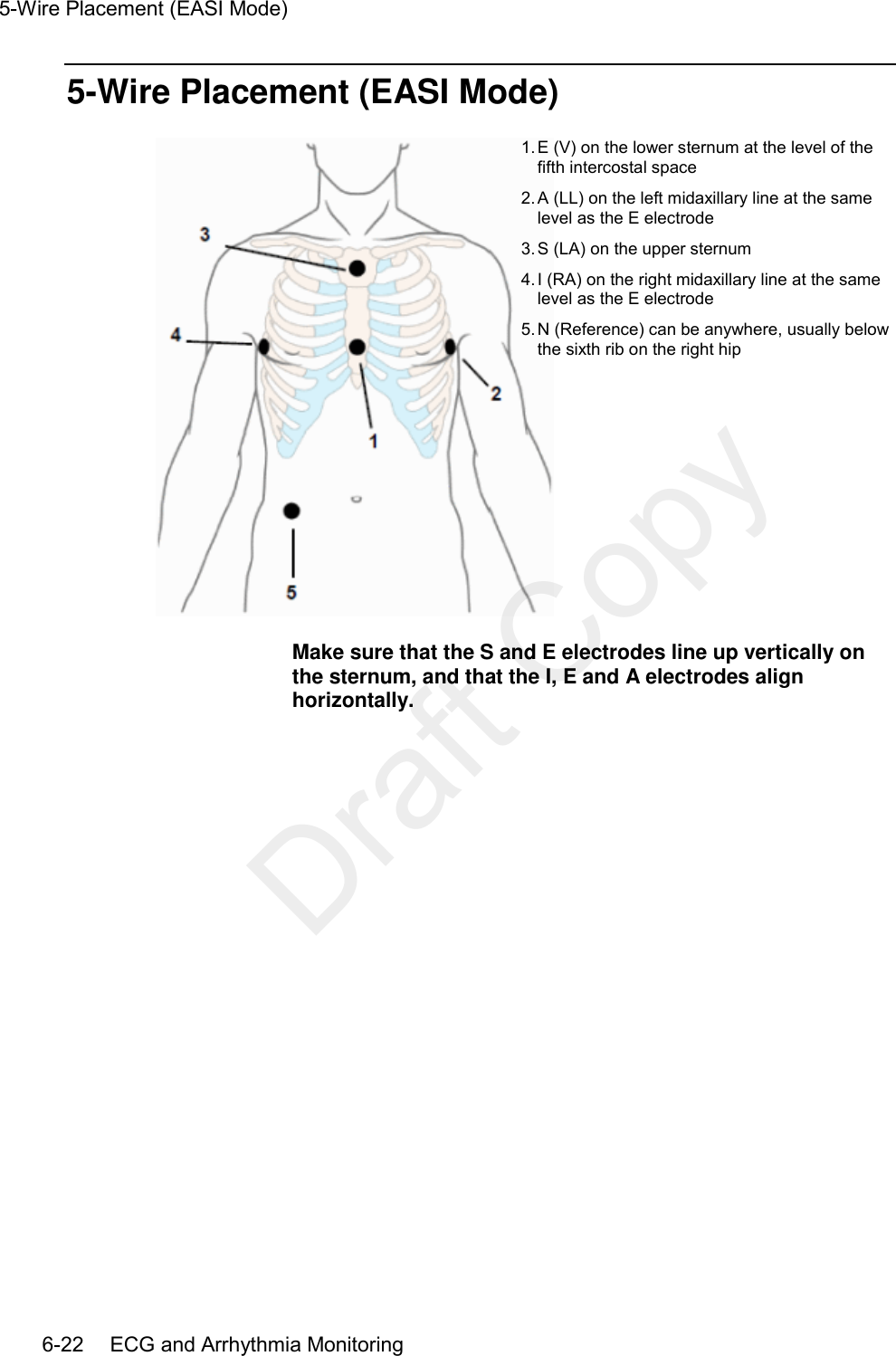 5-Wire Placement (EASI Mode)   6-22    ECG and Arrhythmia Monitoring 5-Wire Placement (EASI Mode)  1. E (V) on the lower sternum at the level of the fifth intercostal space 2. A (LL) on the left midaxillary line at the same level as the E electrode 3. S (LA) on the upper sternum 4. I (RA) on the right midaxillary line at the same level as the E electrode 5. N (Reference) can be anywhere, usually below the sixth rib on the right hip Make sure that the S and E electrodes line up vertically on the sternum, and that the I, E and A electrodes align horizontally.   Draft Copy