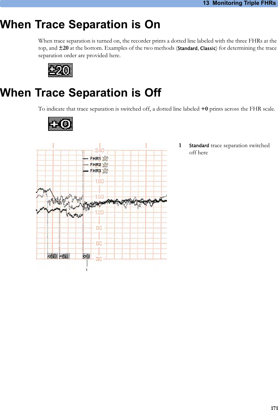13  Monitoring Triple FHRs171When Trace Separation is OnWhen trace separation is turned on, the recorder prints a dotted line labeled with the three FHRs at the top, and ±20 at the bottom. Examples of the two methods (Standard, Classic) for determining the trace separation order are provided here.When Trace Separation is OffTo indicate that trace separation is switched off, a dotted line labeled +0 prints across the FHR scale.1Standard trace separation switched off here