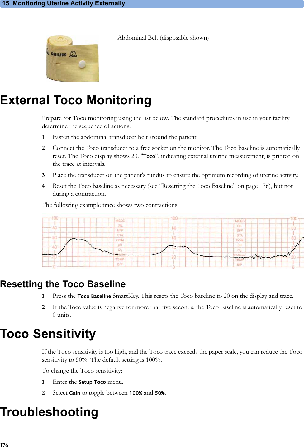 15  Monitoring Uterine Activity Externally176External Toco MonitoringPrepare for Toco monitoring using the list below. The standard procedures in use in your facility determine the sequence of actions.1Fasten the abdominal transducer belt around the patient.2Connect the Toco transducer to a free socket on the monitor. The Toco baseline is automatically reset. The Toco display shows 20. &quot;Toco&quot;, indicating external uterine measurement, is printed on the trace at intervals.3Place the transducer on the patient&apos;s fundus to ensure the optimum recording of uterine activity.4Reset the Toco baseline as necessary (see “Resetting the Toco Baseline” on page 176), but not during a contraction.The following example trace shows two contractions.Resetting the Toco Baseline1Press the Toco Baseline SmartKey. This resets the Toco baseline to 20 on the display and trace.2If the Toco value is negative for more that five seconds, the Toco baseline is automatically reset to 0 units.Toco SensitivityIf the Toco sensitivity is too high, and the Toco trace exceeds the paper scale, you can reduce the Toco sensitivity to 50%. The default setting is 100%.To change the Toco sensitivity:1Enter the Setup Toco menu.2Select Gain to toggle between 100% and 50%.TroubleshootingAbdominal Belt (disposable shown)