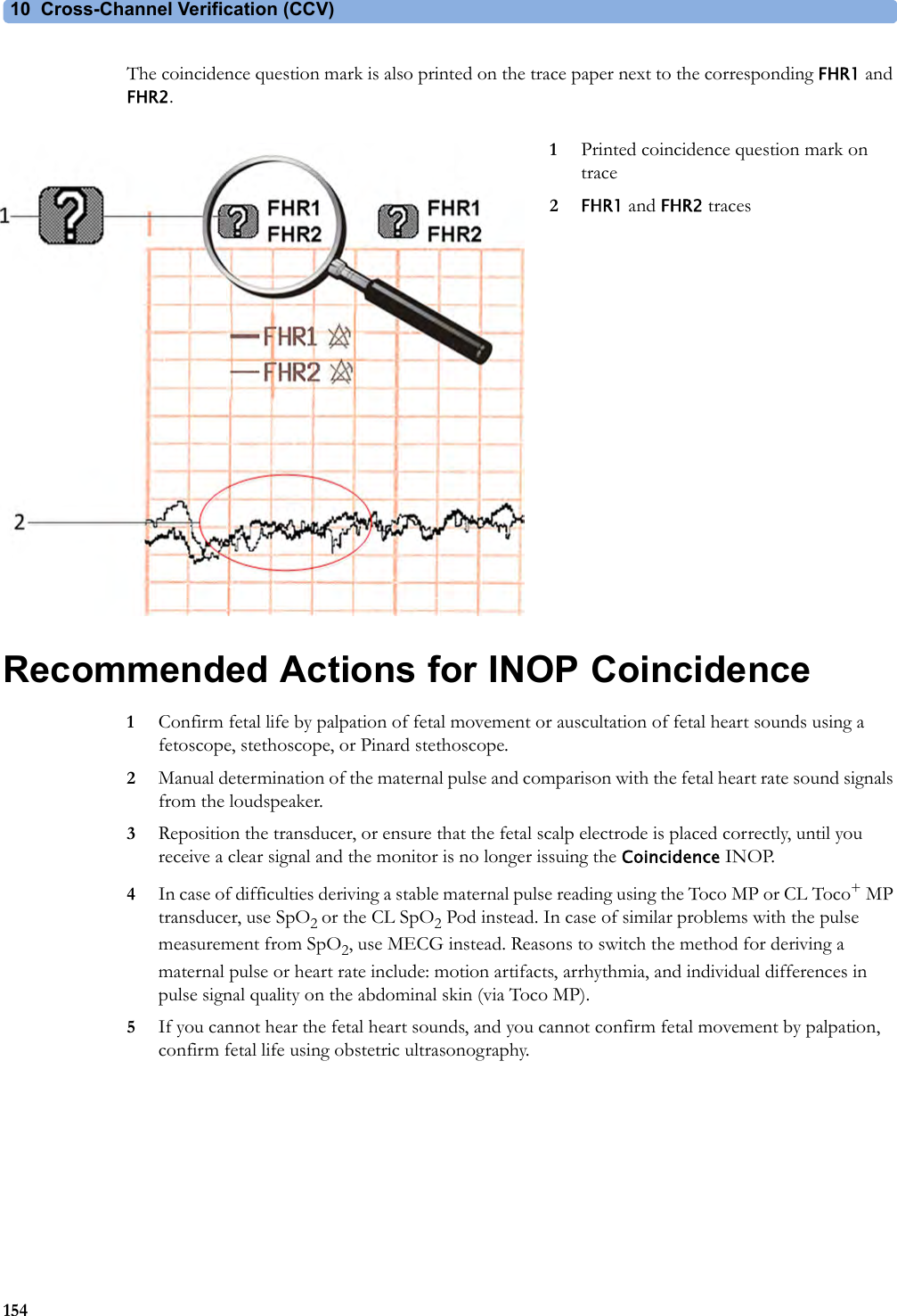 10 Cross-Channel Verification (CCV)154The coincidence question mark is also printed on the trace paper next to the corresponding FHR1 and FHR2.Recommended Actions for INOP Coincidence1Confirm fetal life by palpation of fetal movement or auscultation of fetal heart sounds using a fetoscope, stethoscope, or Pinard stethoscope.2Manual determination of the maternal pulse and comparison with the fetal heart rate sound signals from the loudspeaker.3Reposition the transducer, or ensure that the fetal scalp electrode is placed correctly, until you receive a clear signal and the monitor is no longer issuing the Coincidence INOP.4In case of difficulties deriving a stable maternal pulse reading using the Toco MP or CL Toco+MP transducer, use SpO2 or the CL SpO2 Pod instead. In case of similar problems with the pulse measurement from SpO2, use MECG instead. Reasons to switch the method for deriving a maternal pulse or heart rate include: motion artifacts, arrhythmia, and individual differences in pulse signal quality on the abdominal skin (via Toco MP).5If you cannot hear the fetal heart sounds, and you cannot confirm fetal movement by palpation, confirm fetal life using obstetric ultrasonography.1Printed coincidence question mark on trace2FHR1 and FHR2 traces
