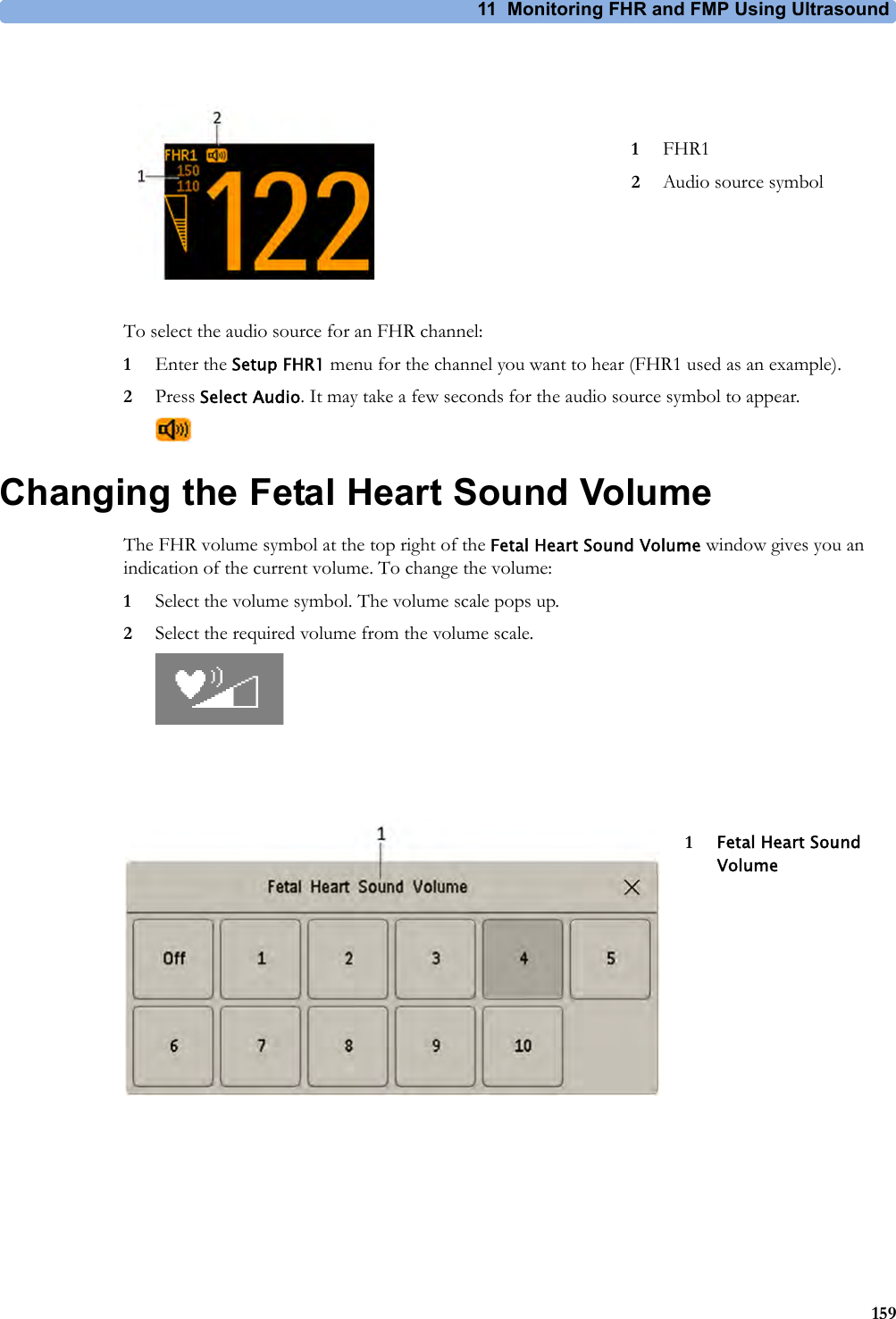 11 Monitoring FHR and FMP Using Ultrasound159To select the audio source for an FHR channel:1Enter the Setup FHR1 menu for the channel you want to hear (FHR1 used as an example).2Press Select Audio. It may take a few seconds for the audio source symbol to appear.Changing the Fetal Heart Sound VolumeThe FHR volume symbol at the top right of the Fetal Heart Sound Volume window gives you an indication of the current volume. To change the volume:1Select the volume symbol. The volume scale pops up.2Select the required volume from the volume scale.1FHR12Audio source symbol1Fetal Heart Sound Volume