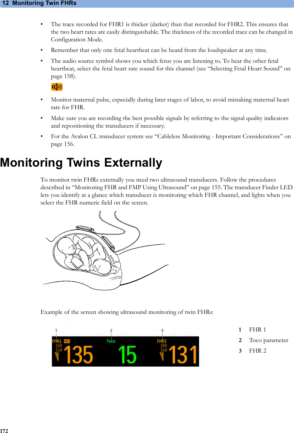 12 Monitoring Twin FHRs172• The trace recorded for FHR1 is thicker (darker) than that recorded for FHR2. This ensures that the two heart rates are easily distinguishable. The thickness of the recorded trace can be changed in Configuration Mode.• Remember that only one fetal heartbeat can be heard from the loudspeaker at any time.• The audio source symbol shows you which fetus you are listening to. To hear the other fetal heartbeat, select the fetal heart rate sound for this channel (see “Selecting Fetal Heart Sound” on page 158).• Monitor maternal pulse, especially during later stages of labor, to avoid mistaking maternal heart rate for FHR.• Make sure you are recording the best possible signals by referring to the signal quality indicators and repositioning the transducers if necessary.• For the Avalon CL transducer system see “Cableless Monitoring - Important Considerations” on page 156.Monitoring Twins ExternallyTo monitor twin FHRs externally you need two ultrasound transducers. Follow the procedures described in “Monitoring FHR and FMP Using Ultrasound” on page 155. The transducer Finder LED lets you identify at a glance which transducer is monitoring which FHR channel, and lights when you select the FHR numeric field on the screen.Example of the screen showing ultrasound monitoring of twin FHRs:1FHR 12Toco parameter3FHR 2