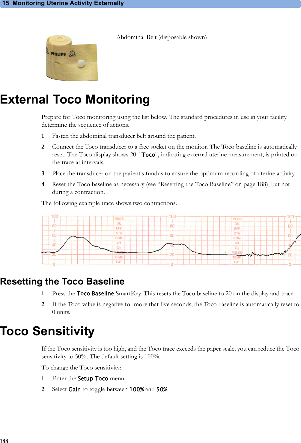 15 Monitoring Uterine Activity Externally188External Toco MonitoringPrepare for Toco monitoring using the list below. The standard procedures in use in your facility determine the sequence of actions.1Fasten the abdominal transducer belt around the patient.2Connect the Toco transducer to a free socket on the monitor. The Toco baseline is automatically reset. The Toco display shows 20. &quot;Toco&quot;, indicating external uterine measurement, is printed on the trace at intervals.3Place the transducer on the patient&apos;s fundus to ensure the optimum recording of uterine activity.4Reset the Toco baseline as necessary (see “Resetting the Toco Baseline” on page 188), but not during a contraction.The following example trace shows two contractions.Resetting the Toco Baseline1Press the Toco Baseline SmartKey. This resets the Toco baseline to 20 on the display and trace.2If the Toco value is negative for more that five seconds, the Toco baseline is automatically reset to 0 units.Toco SensitivityIf the Toco sensitivity is too high, and the Toco trace exceeds the paper scale, you can reduce the Toco sensitivity to 50%. The default setting is 100%.To change the Toco sensitivity:1Enter the Setup Toco menu.2Select Gain to toggle between 100% and 50%.Abdominal Belt (disposable shown)