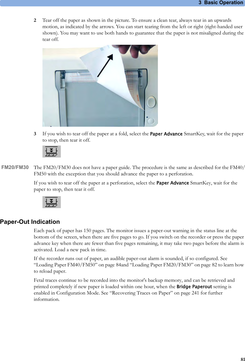 3 Basic Operation812Tear off the paper as shown in the picture. To ensure a clean tear, always tear in an upwards motion, as indicated by the arrows. You can start tearing from the left or right (right-handed user shown). You may want to use both hands to guarantee that the paper is not misaligned during the tear off.3If you wish to tear off the paper at a fold, select the Paper Advance SmartKey, wait for the paper to stop, then tear it off.FM20/FM30 The FM20/FM30 does not have a paper guide. The procedure is the same as described for the FM40/FM50 with the exception that you should advance the paper to a perforation. If you wish to tear off the paper at a perforation, select the Paper Advance SmartKey, wait for the paper to stop, then tear it off.Paper-Out IndicationEach pack of paper has 150 pages. The monitor issues a paper-out warning in the status line at the bottom of the screen, when there are five pages to go. If you switch on the recorder or press the paper advance key when there are fewer than five pages remaining, it may take two pages before the alarm is activated. Load a new pack in time.If the recorder runs out of paper, an audible paper-out alarm is sounded, if so configured. See “Loading Paper FM40/FM50” on page 84and “Loading Paper FM20/FM30” on page 82 to learn how to reload paper. Fetal traces continue to be recorded into the monitor&apos;s backup memory, and can be retrieved and printed completely if new paper is loaded within one hour, when the Bridge Paperout setting is enabled in Configuration Mode. See “Recovering Traces on Paper” on page 241 for further information.