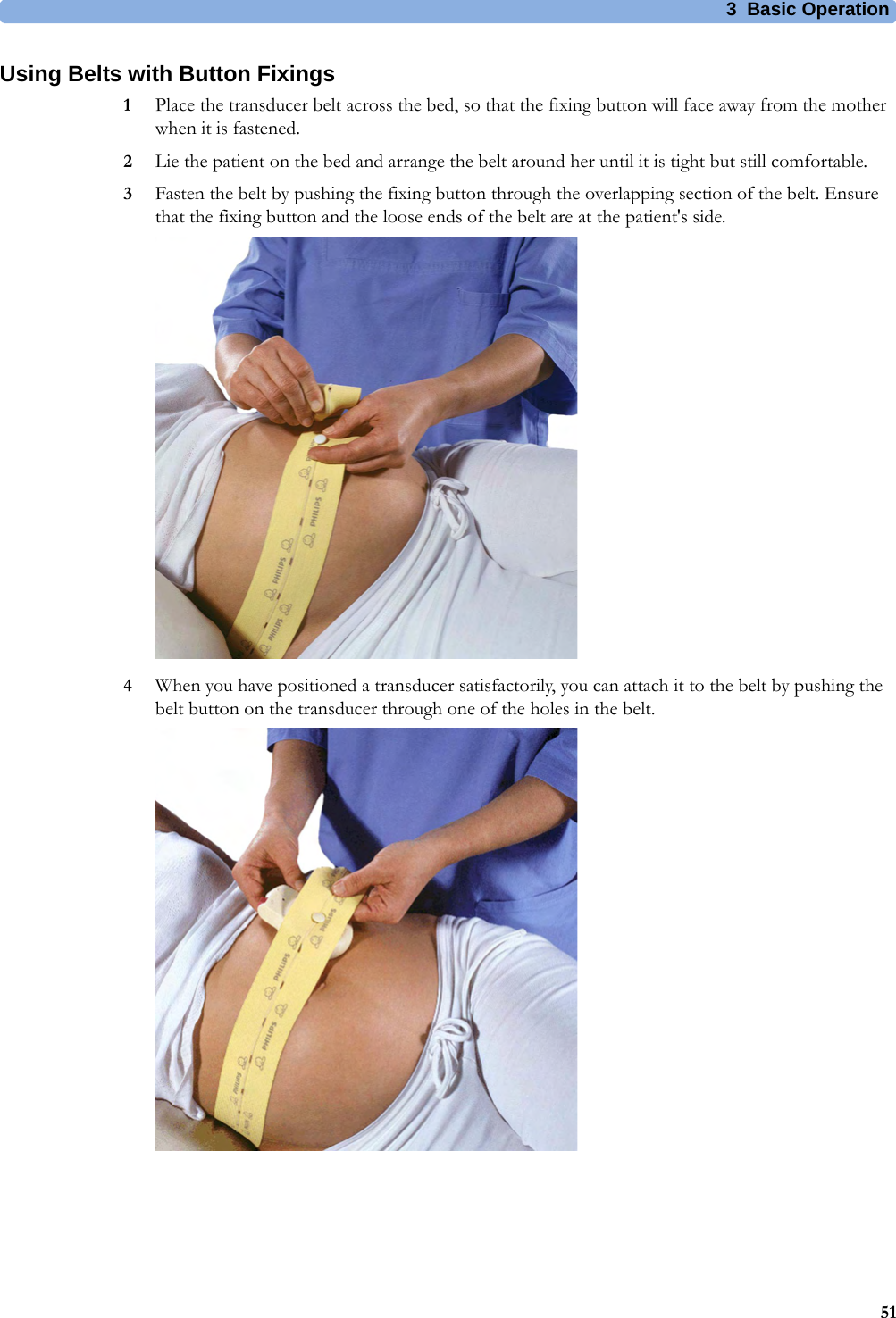 3  Basic Operation51Using Belts with Button Fixings1Place the transducer belt across the bed, so that the fixing button will face away from the mother when it is fastened.2Lie the patient on the bed and arrange the belt around her until it is tight but still comfortable.3Fasten the belt by pushing the fixing button through the overlapping section of the belt. Ensure that the fixing button and the loose ends of the belt are at the patient&apos;s side.4When you have positioned a transducer satisfactorily, you can attach it to the belt by pushing the belt button on the transducer through one of the holes in the belt.