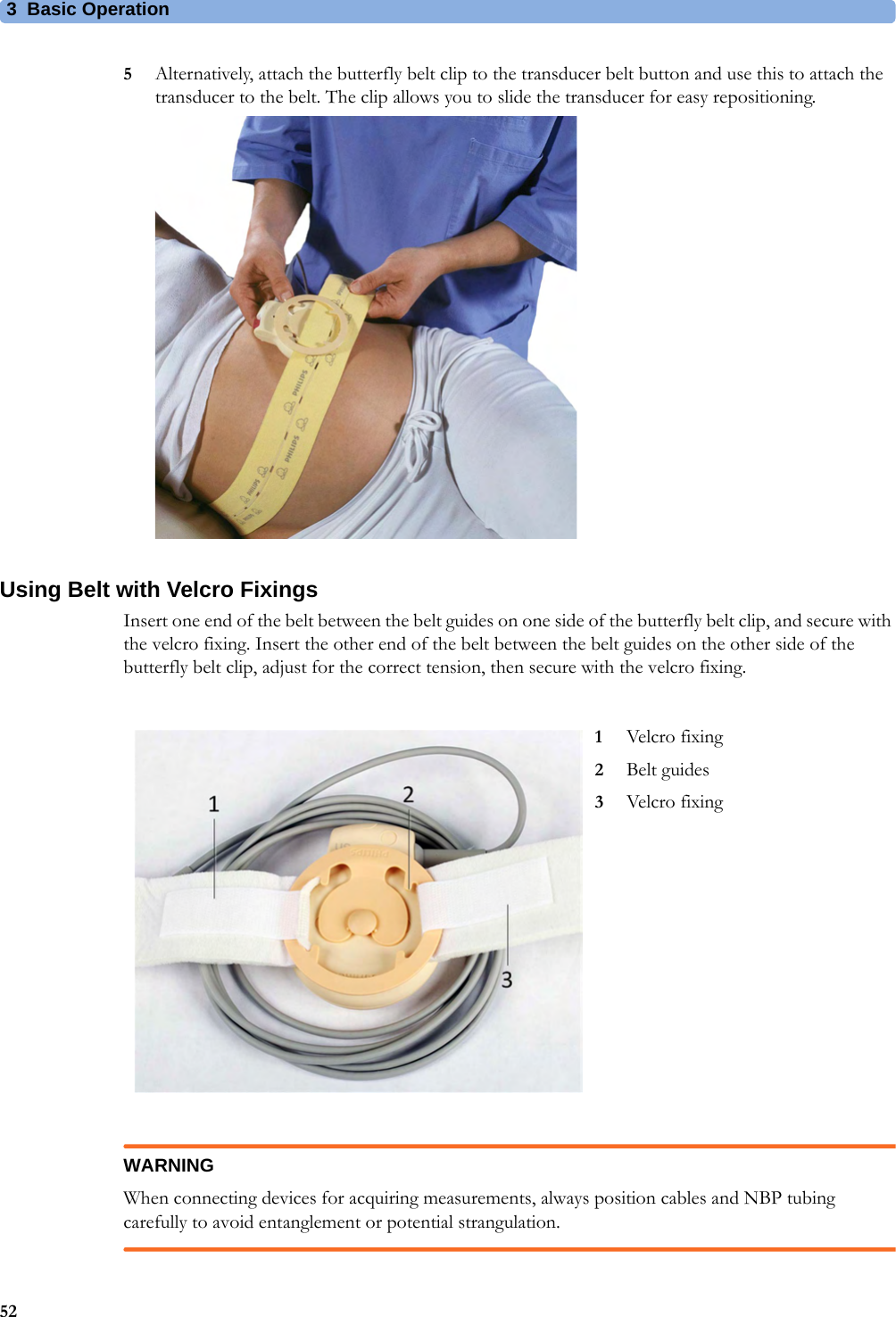 3  Basic Operation525Alternatively, attach the butterfly belt clip to the transducer belt button and use this to attach the transducer to the belt. The clip allows you to slide the transducer for easy repositioning.Using Belt with Velcro FixingsInsert one end of the belt between the belt guides on one side of the butterfly belt clip, and secure with the velcro fixing. Insert the other end of the belt between the belt guides on the other side of the butterfly belt clip, adjust for the correct tension, then secure with the velcro fixing.WARNINGWhen connecting devices for acquiring measurements, always position cables and NBP tubing carefully to avoid entanglement or potential strangulation.1Velcro fixing2Belt guides3Velcro fixing