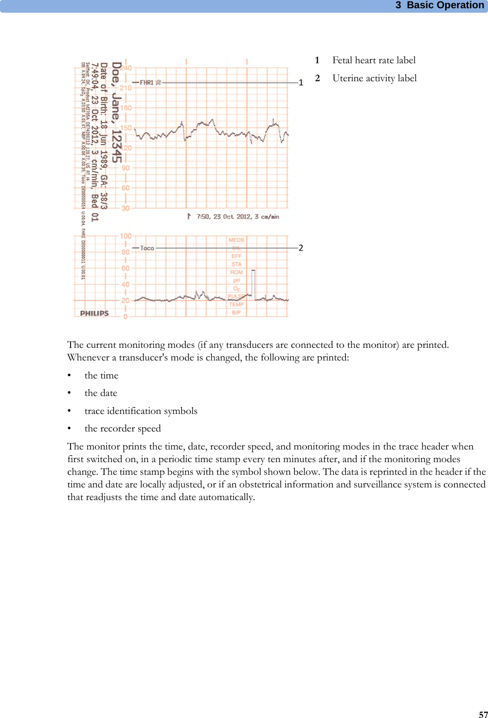 3  Basic Operation57The current monitoring modes (if any transducers are connected to the monitor) are printed. Whenever a transducer&apos;s mode is changed, the following are printed:•the time•the date• trace identification symbols• the recorder speedThe monitor prints the time, date, recorder speed, and monitoring modes in the trace header when first switched on, in a periodic time stamp every ten minutes after, and if the monitoring modes change. The time stamp begins with the symbol shown below. The data is reprinted in the header if the time and date are locally adjusted, or if an obstetrical information and surveillance system is connected that readjusts the time and date automatically.1Fetal heart rate label2Uterine activity label