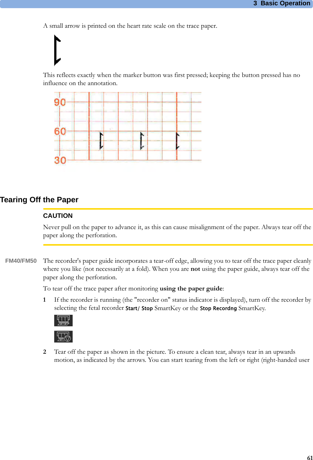 3  Basic Operation61A small arrow is printed on the heart rate scale on the trace paper.This reflects exactly when the marker button was first pressed; keeping the button pressed has no influence on the annotation.Tearing Off the PaperCAUTIONNever pull on the paper to advance it, as this can cause misalignment of the paper. Always tear off the paper along the perforation.FM40/FM50 The recorder&apos;s paper guide incorporates a tear-off edge, allowing you to tear off the trace paper cleanly where you like (not necessarily at a fold). When you are not using the paper guide, always tear off the paper along the perforation.To tear off the trace paper after monitoring using the paper guide:1If the recorder is running (the &quot;recorder on&quot; status indicator is displayed), turn off the recorder by selecting the fetal recorder Start/ Stop SmartKey or the Stop Recordng SmartKey.2Tear off the paper as shown in the picture. To ensure a clean tear, always tear in an upwards motion, as indicated by the arrows. You can start tearing from the left or right (right-handed user 