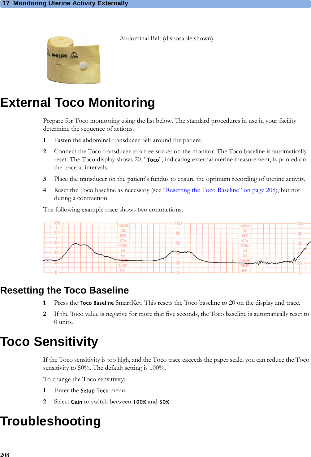 17  Monitoring Uterine Activity Externally208External Toco MonitoringPrepare for Toco monitoring using the list below. The standard procedures in use in your facility determine the sequence of actions.1Fasten the abdominal transducer belt around the patient.2Connect the Toco transducer to a free socket on the monitor. The Toco baseline is automatically reset. The Toco display shows 20. &quot;Toco&quot;, indicating external uterine measurement, is printed on the trace at intervals.3Place the transducer on the patient&apos;s fundus to ensure the optimum recording of uterine activity.4Reset the Toco baseline as necessary (see “Resetting the Toco Baseline” on page 208), but not during a contraction.The following example trace shows two contractions.Resetting the Toco Baseline1Press the Toco Baseline SmartKey. This resets the Toco baseline to 20 on the display and trace.2If the Toco value is negative for more that five seconds, the Toco baseline is automatically reset to 0 units.Toco SensitivityIf the Toco sensitivity is too high, and the Toco trace exceeds the paper scale, you can reduce the Toco sensitivity to 50%. The default setting is 100%.To change the Toco sensitivity:1Enter the Setup Toco menu.2Select Gain to switch between 100% and 50%.TroubleshootingAbdominal Belt (disposable shown)