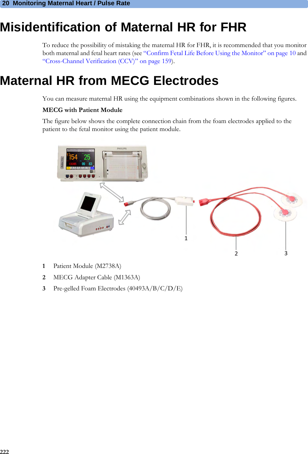 20  Monitoring Maternal Heart / Pulse Rate222Misidentification of Maternal HR for FHRTo reduce the possibility of mistaking the maternal HR for FHR, it is recommended that you monitor both maternal and fetal heart rates (see “Confirm Fetal Life Before Using the Monitor” on page 10 and “Cross-Channel Verification (CCV)” on page 159).Maternal HR from MECG ElectrodesYou can measure maternal HR using the equipment combinations shown in the following figures.MECG with Patient ModuleThe figure below shows the complete connection chain from the foam electrodes applied to the patient to the fetal monitor using the patient module.1Patient Module (M2738A)2MECG Adapter Cable (M1363A)3Pre-gelled Foam Electrodes (40493A/B/C/D/E)