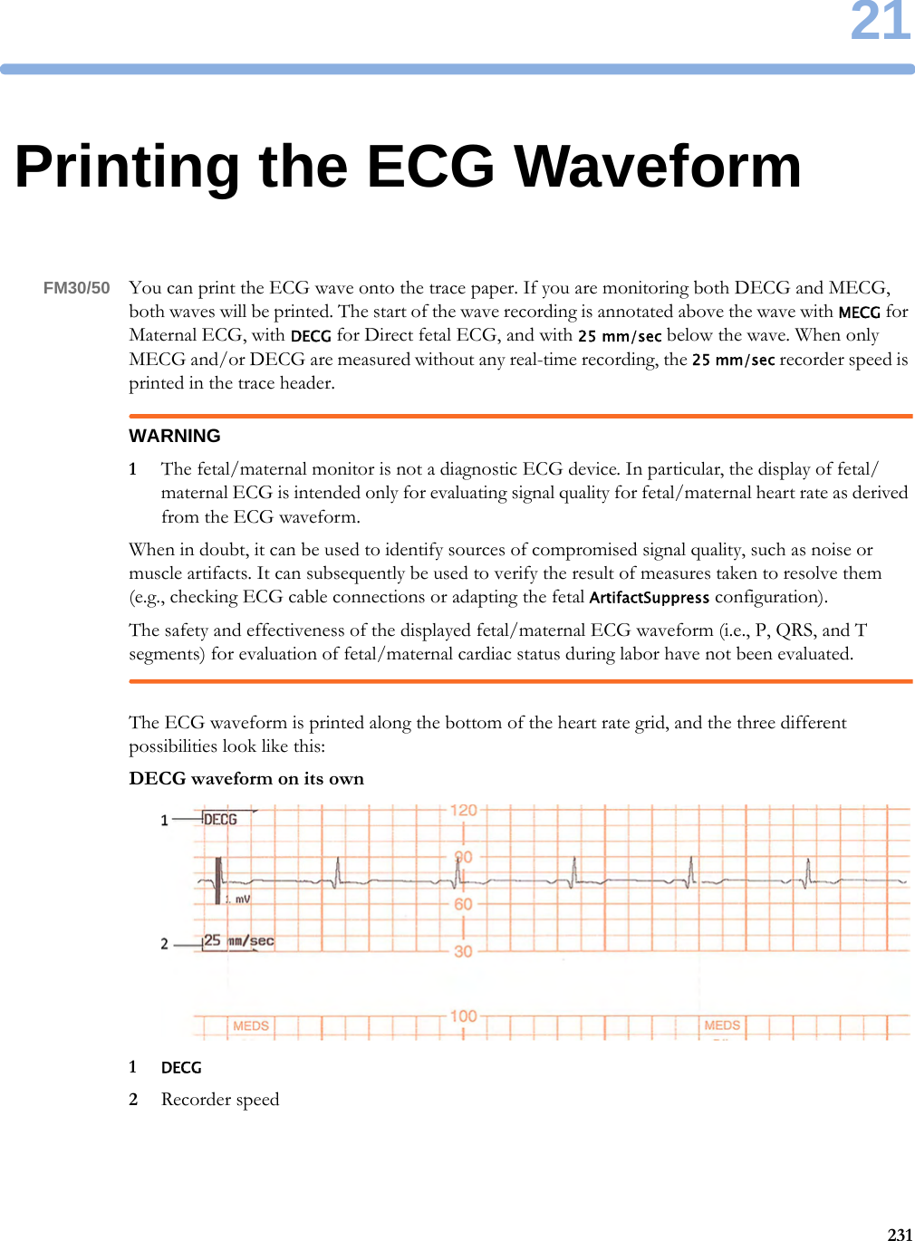 2123121Printing the ECG WaveformFM30/50 You can print the ECG wave onto the trace paper. If you are monitoring both DECG and MECG, both waves will be printed. The start of the wave recording is annotated above the wave with MECG for Maternal ECG, with DECG for Direct fetal ECG, and with 25 mm/sec below the wave. When only MECG and/or DECG are measured without any real-time recording, the 25 mm/sec recorder speed is printed in the trace header.WARNING1The fetal/maternal monitor is not a diagnostic ECG device. In particular, the display of fetal/maternal ECG is intended only for evaluating signal quality for fetal/maternal heart rate as derived from the ECG waveform.When in doubt, it can be used to identify sources of compromised signal quality, such as noise or muscle artifacts. It can subsequently be used to verify the result of measures taken to resolve them (e.g., checking ECG cable connections or adapting the fetal ArtifactSuppress configuration).The safety and effectiveness of the displayed fetal/maternal ECG waveform (i.e., P, QRS, and T segments) for evaluation of fetal/maternal cardiac status during labor have not been evaluated.The ECG waveform is printed along the bottom of the heart rate grid, and the three different possibilities look like this:DECG waveform on its own1DECG2Recorder speed
