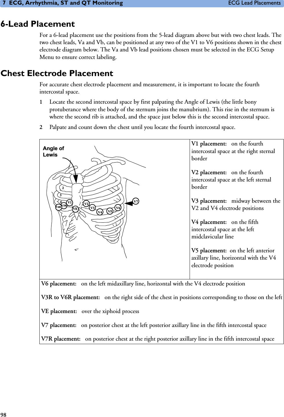 7 ECG, Arrhythmia, ST and QT Monitoring ECG Lead Placements986-Lead PlacementFor a 6-lead placement use the positions from the 5-lead diagram above but with two chest leads. The two chest leads, Va and Vb, can be positioned at any two of the V1 to V6 positions shown in the chest electrode diagram below. The Va and Vb lead positions chosen must be selected in the ECG Setup Menu to ensure correct labeling. Chest Electrode PlacementFor accurate chest electrode placement and measurement, it is important to locate the fourth intercostal space. 1Locate the second intercostal space by first palpating the Angle of Lewis (the little bony protuberance where the body of the sternum joins the manubrium). This rise in the sternum is where the second rib is attached, and the space just below this is the second intercostal space. 2Palpate and count down the chest until you locate the fourth intercostal space.V1 placement:  on the fourth intercostal space at the right sternal borderV2 placement:  on the fourth intercostal space at the left sternal borderV3 placement:  midway between the V2 and V4 electrode positionsV4 placement:  on the fifth intercostal space at the left midclavicular lineV5 placement: on the left anterior axillary line, horizontal with the V4 electrode positionV6 placement:  on the left midaxillary line, horizontal with the V4 electrode positionV3R to V6R placement:  on the right side of the chest in positions corresponding to those on the leftVE placement:  over the xiphoid processV7 placement:  on posterior chest at the left posterior axillary line in the fifth intercostal spaceV7R placement:  on posterior chest at the right posterior axillary line in the fifth intercostal spaceVEV1 V2V3V4 V5V6V7V3RV4R234Angle of Lewis