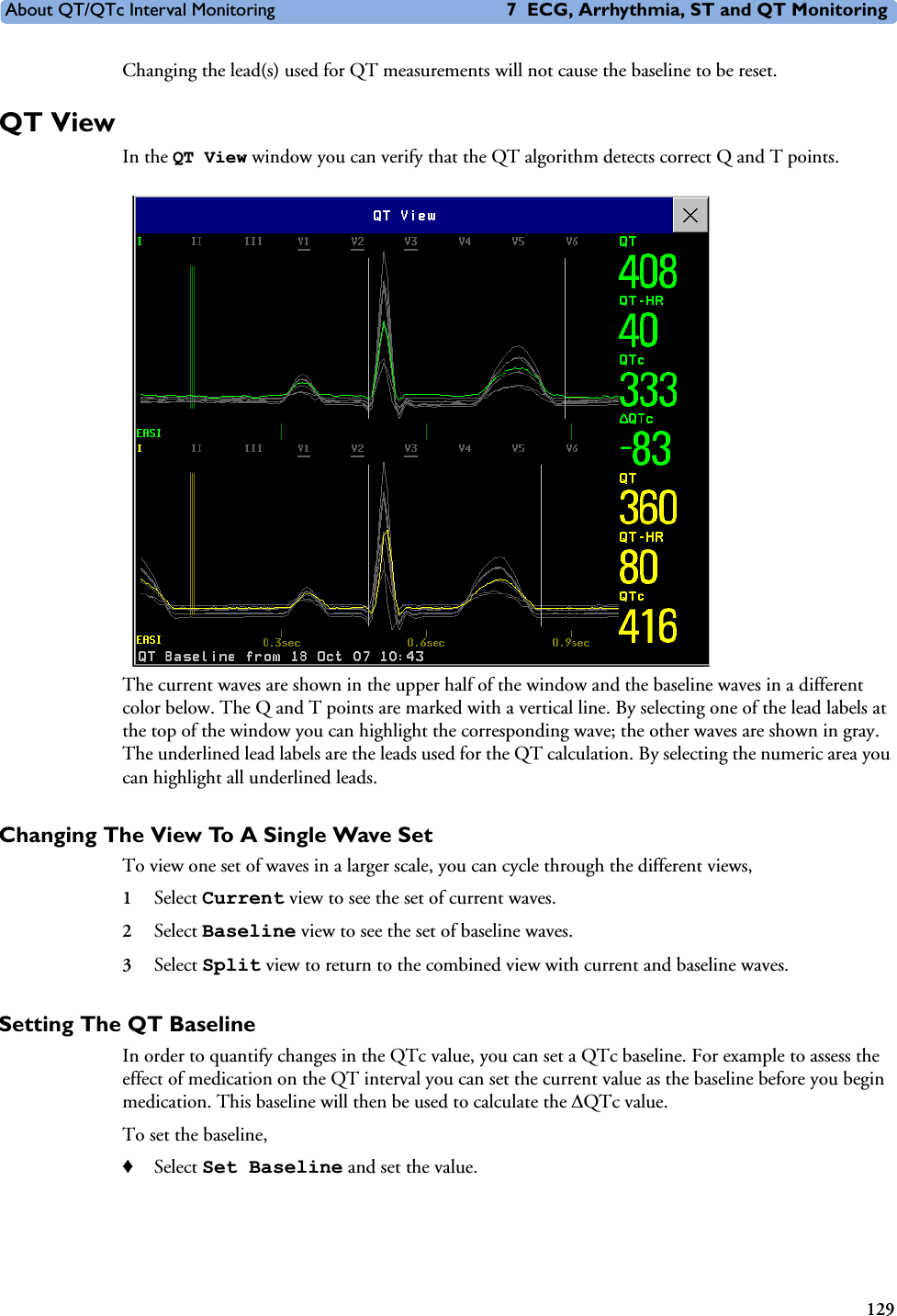 About QT/QTc Interval Monitoring 7 ECG, Arrhythmia, ST and QT Monitoring129Changing the lead(s) used for QT measurements will not cause the baseline to be reset. QT ViewIn the QT View window you can verify that the QT algorithm detects correct Q and T points. The current waves are shown in the upper half of the window and the baseline waves in a different color below. The Q and T points are marked with a vertical line. By selecting one of the lead labels at the top of the window you can highlight the corresponding wave; the other waves are shown in gray. The underlined lead labels are the leads used for the QT calculation. By selecting the numeric area you can highlight all underlined leads. Changing The View To A Single Wave SetTo view one set of waves in a larger scale, you can cycle through the different views, 1Select Current view to see the set of current waves.2Select Baseline view to see the set of baseline waves. 3Select Split view to return to the combined view with current and baseline waves. Setting The QT BaselineIn order to quantify changes in the QTc value, you can set a QTc baseline. For example to assess the effect of medication on the QT interval you can set the current value as the baseline before you begin medication. This baseline will then be used to calculate the &apos;QTc value. To set the baseline, ♦Select Set Baseline and set the value. 