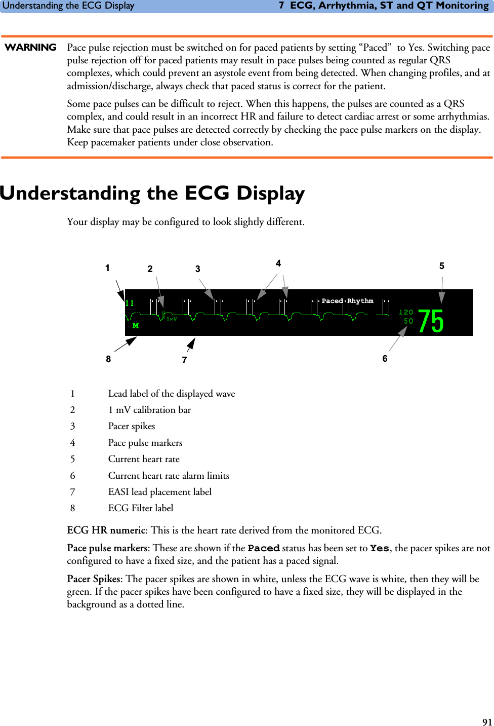 Understanding the ECG Display 7 ECG, Arrhythmia, ST and QT Monitoring91WARNING Pace pulse rejection must be switched on for paced patients by setting “Paced”  to Yes. Switching pace pulse rejection off for paced patients may result in pace pulses being counted as regular QRS complexes, which could prevent an asystole event from being detected. When changing profiles, and at admission/discharge, always check that paced status is correct for the patient.Some pace pulses can be difficult to reject. When this happens, the pulses are counted as a QRS complex, and could result in an incorrect HR and failure to detect cardiac arrest or some arrhythmias. Make sure that pace pulses are detected correctly by checking the pace pulse markers on the display. Keep pacemaker patients under close observation.Understanding the ECG DisplayYour display may be configured to look slightly different.ECG HR numeric: This is the heart rate derived from the monitored ECG. Pace pulse markers: These are shown if the Paced status has been set to Yes, the pacer spikes are not configured to have a fixed size, and the patient has a paced signal.Pacer Spikes: The pacer spikes are shown in white, unless the ECG wave is white, then they will be green. If the pacer spikes have been configured to have a fixed size, they will be displayed in the background as a dotted line.1 Lead label of the displayed wave2 1 mV calibration bar3Pacer spikes4 Pace pulse markers5 Current heart rate6 Current heart rate alarm limits7 EASI lead placement label8 ECG Filter labelEASIMHR bpm4816573Paced Rhythm2